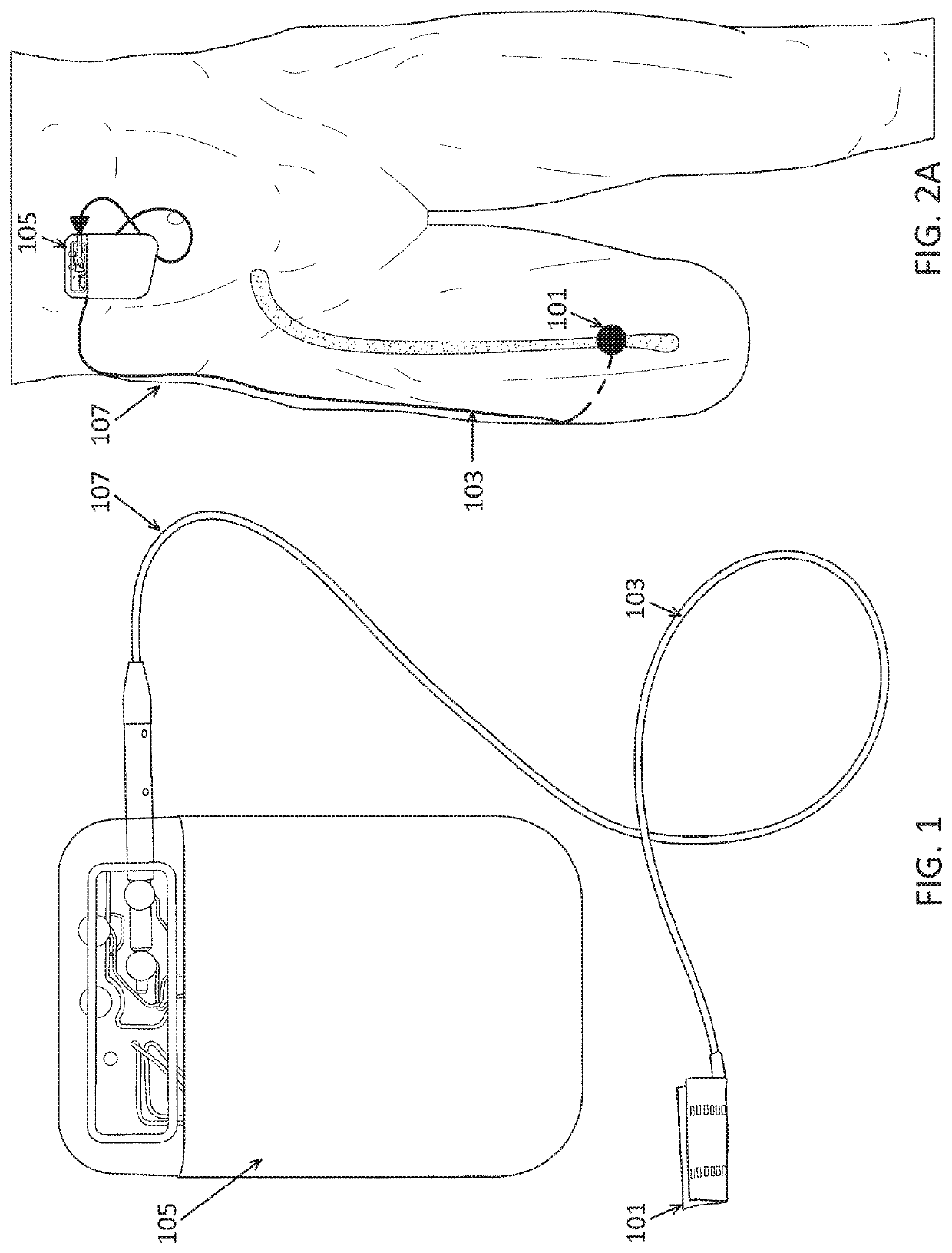 Nerve cuff deployment devices