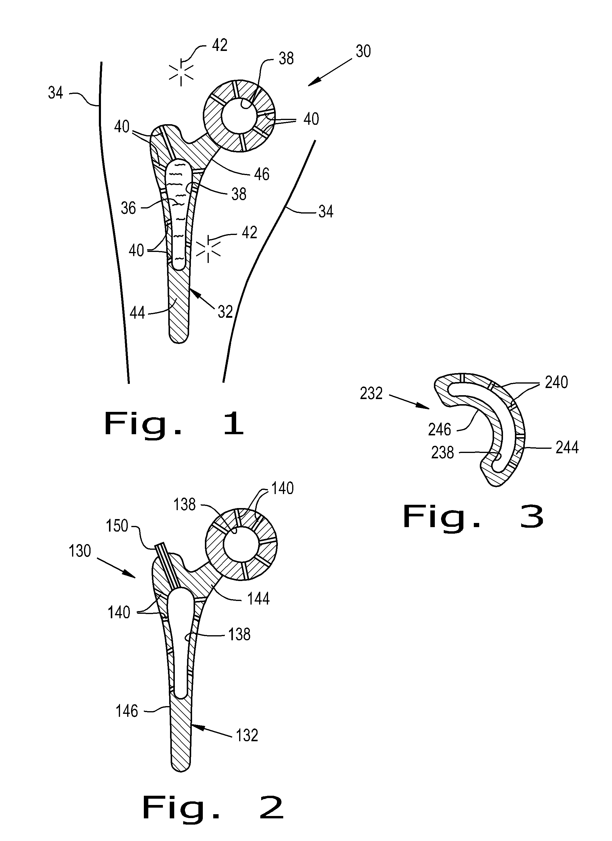 Drug delivery implants