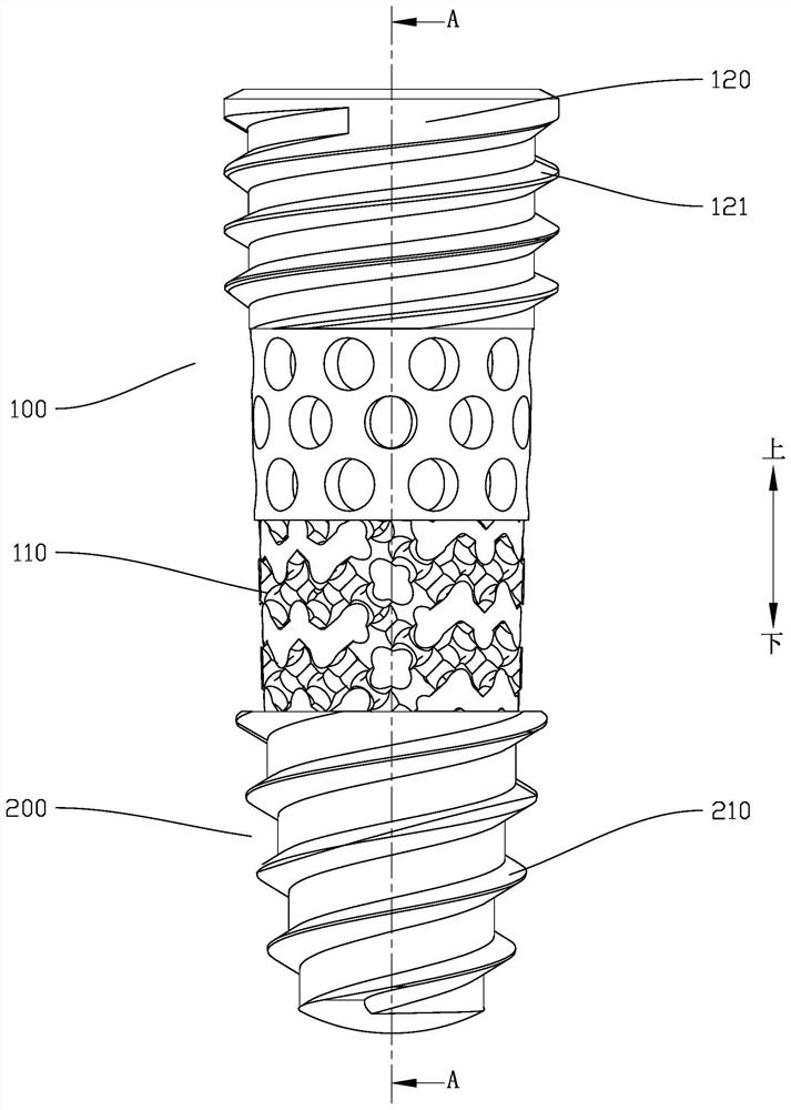 Modularized layered dental implant