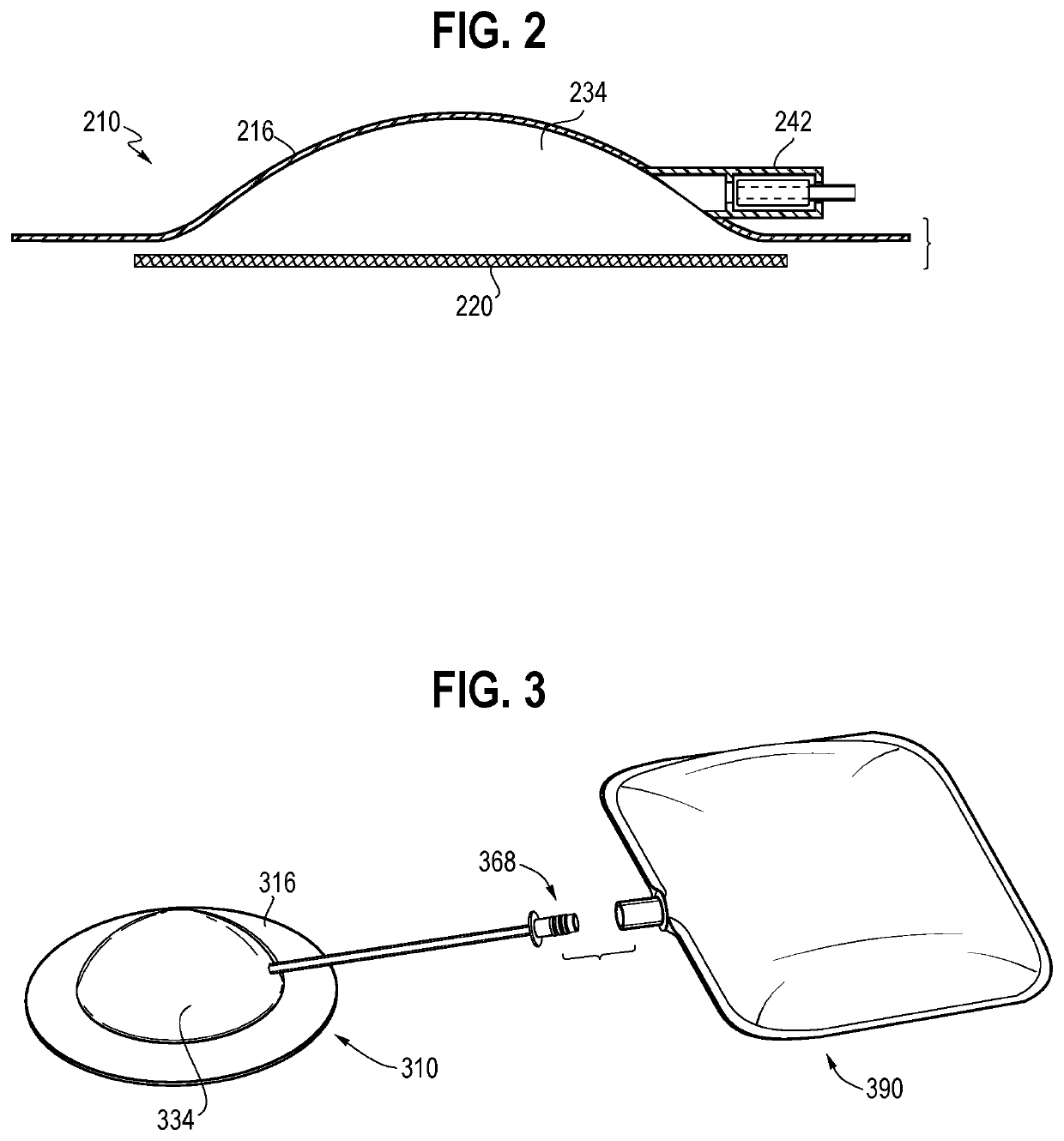 Forward osmosis medical and wound care devices