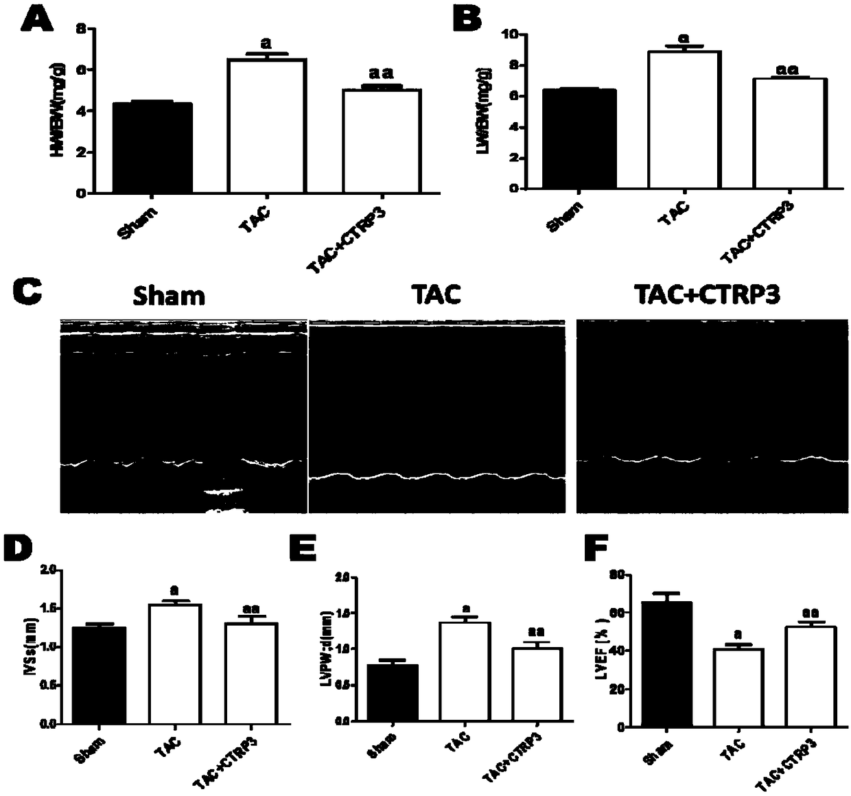 Application of CTRP3 to preparation of drugs for preventing and treating cardiac hypertrophy