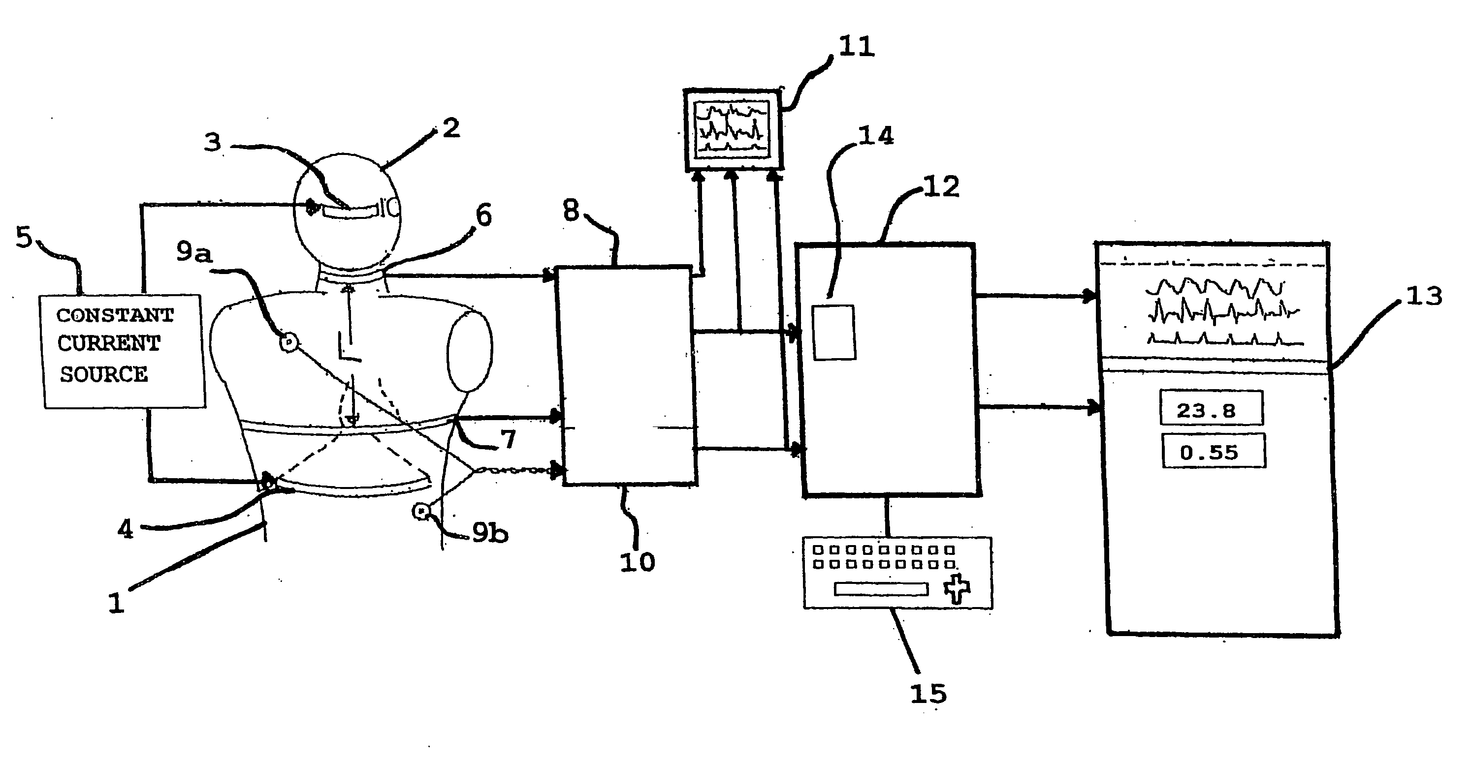 Device and method for measuring cardiac function