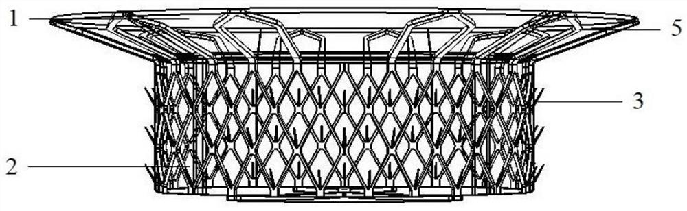 Valve stent and interventional mitral valve replacement system comprising same