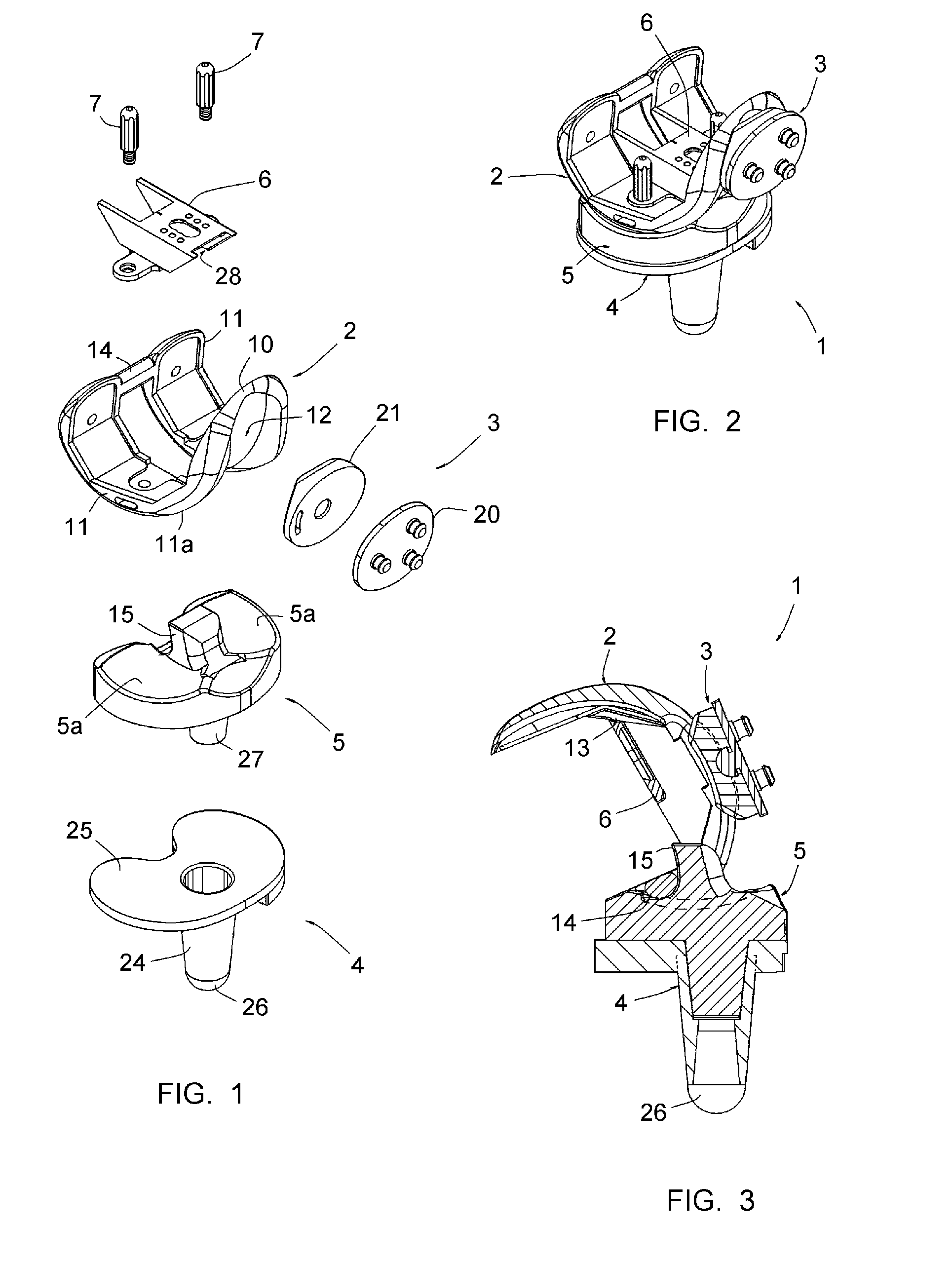 Total knee prosthesis, and set of modular elements making it possible to obtain such a prosthesis