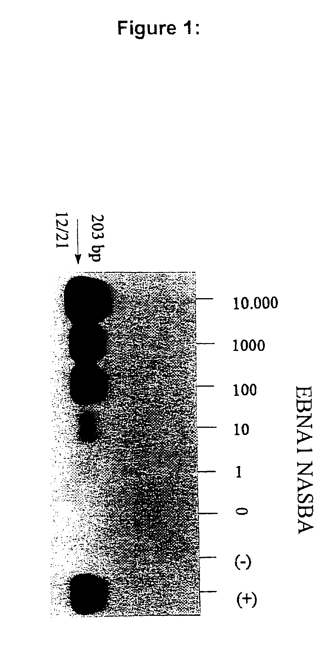 Oligonucleotides for the amplification and detection of Epstein Barr Virus (EBV) nucleic acid