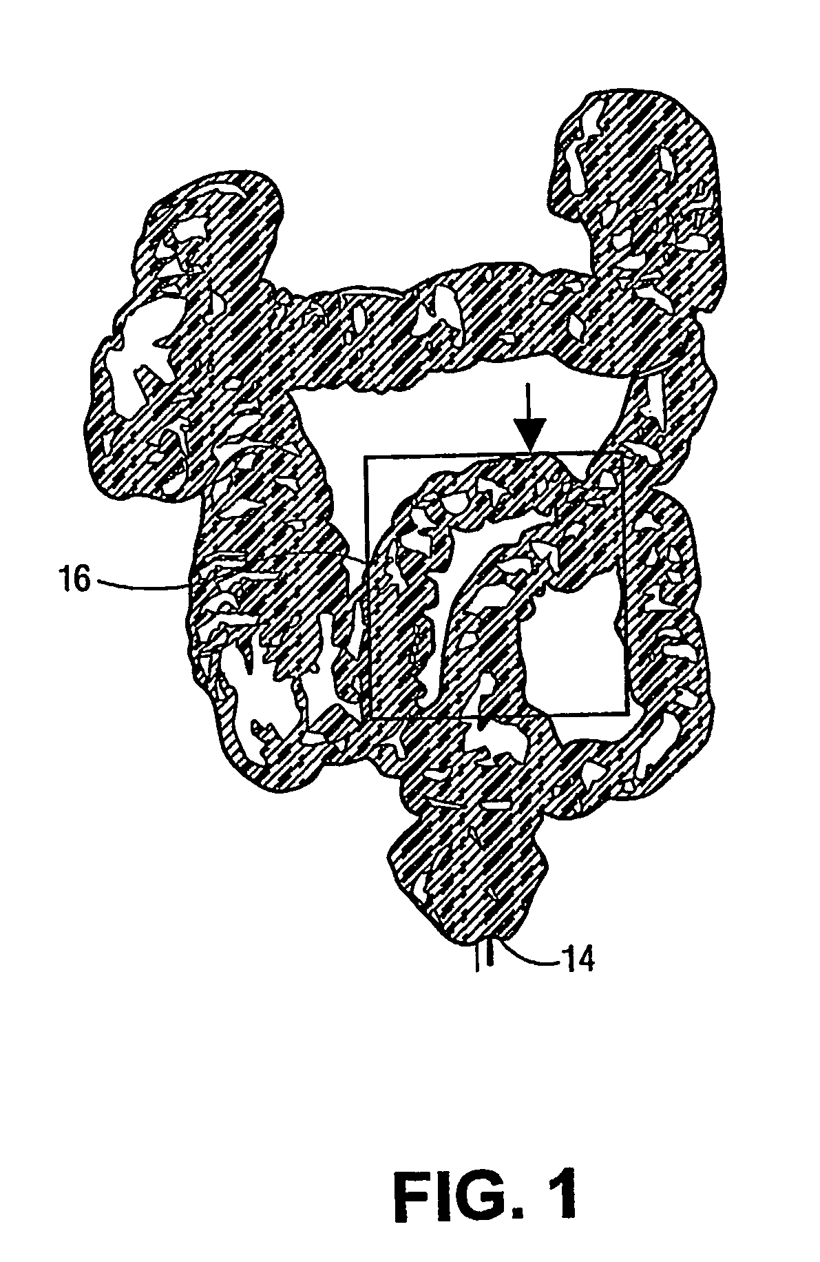 Automated centerline detection algorithm for colon-like 3d surfaces