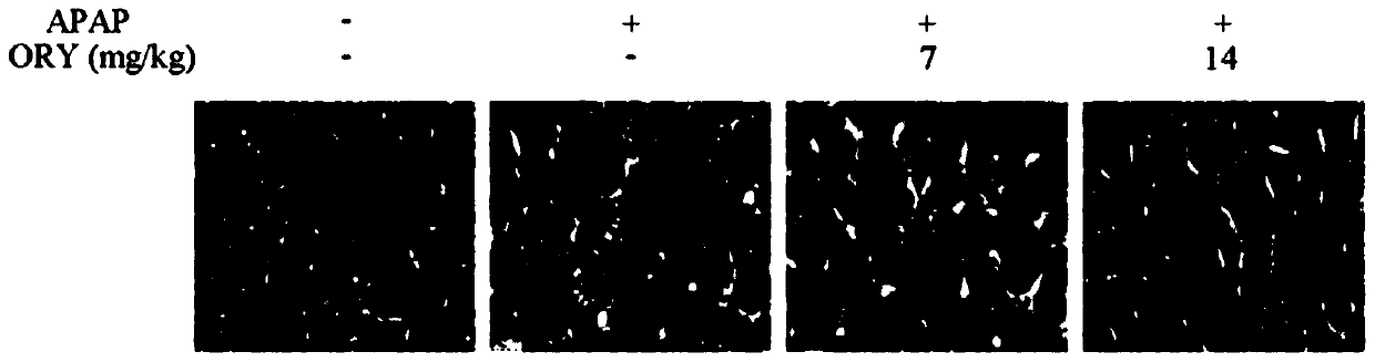 Medicine for preventing and controlling acetaminophen induced liver injury and application of medicine