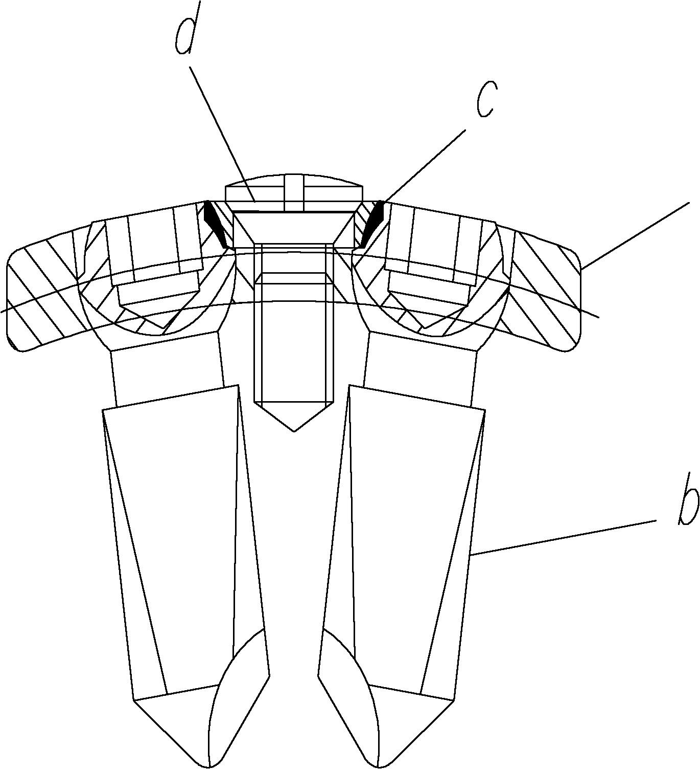 Self-locking fixed part for surgical implant