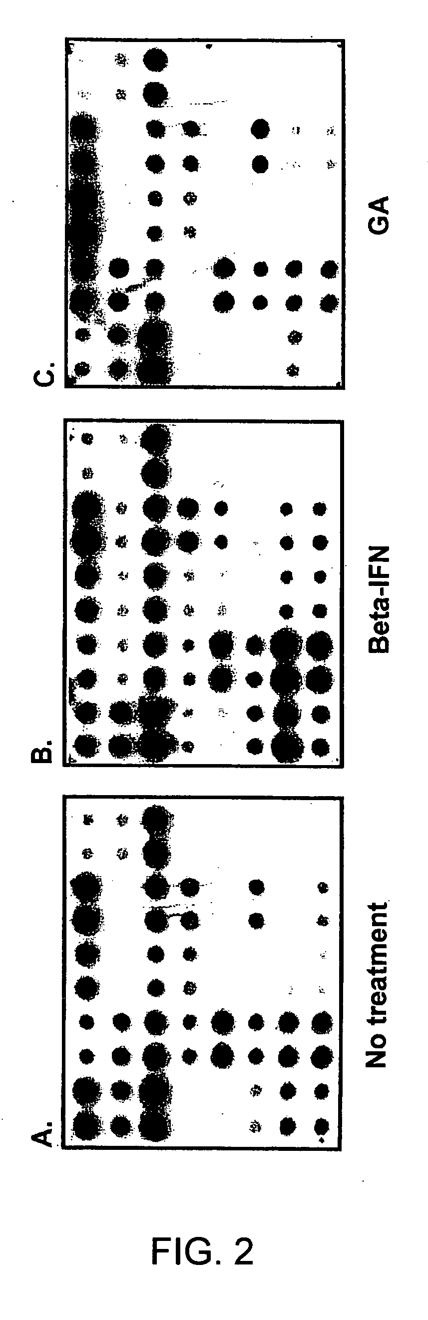 Gene expression profiling technology for treatment evaluation of multiple sclerosis