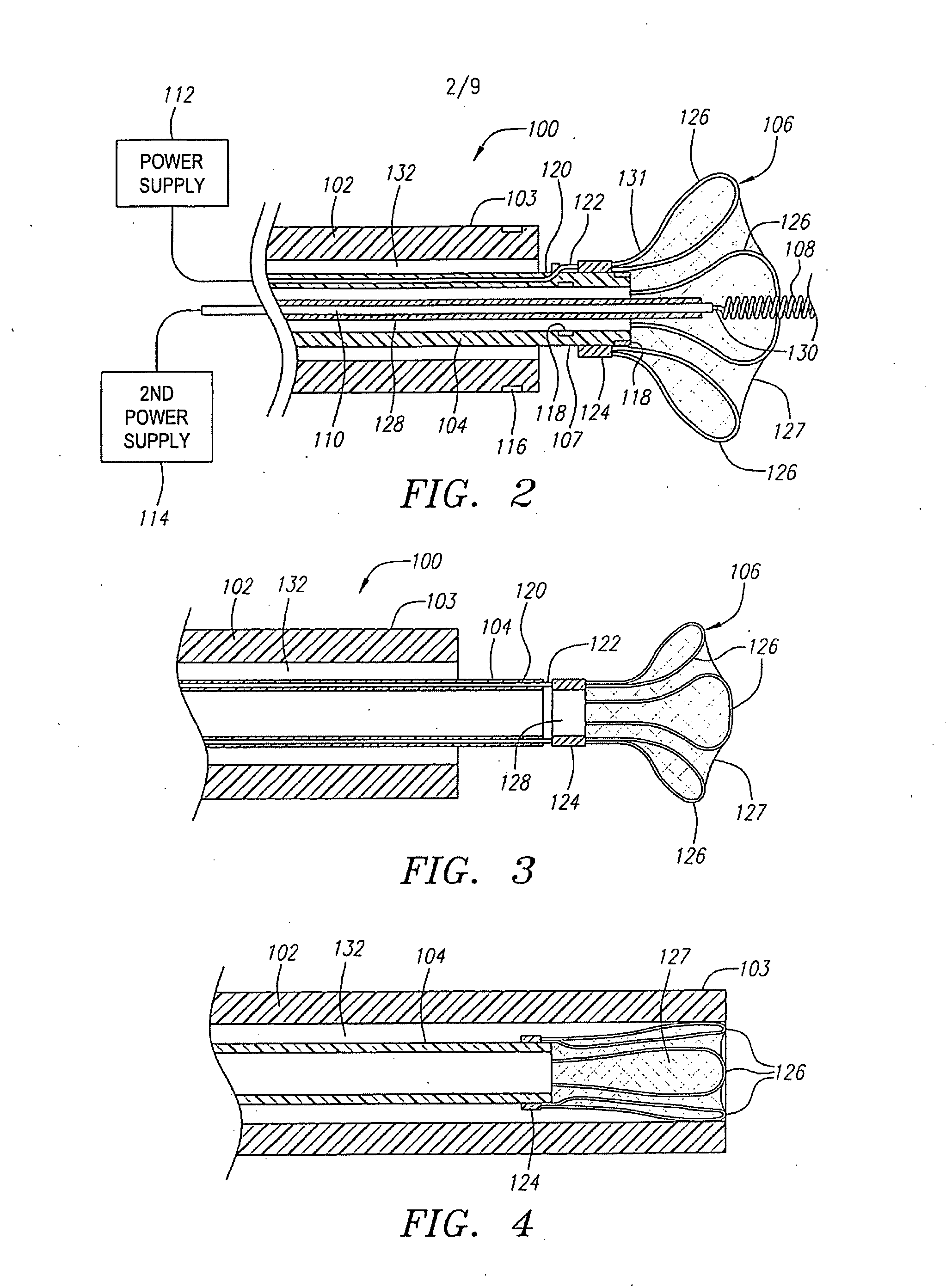 Detachable aneurysm neck bridge