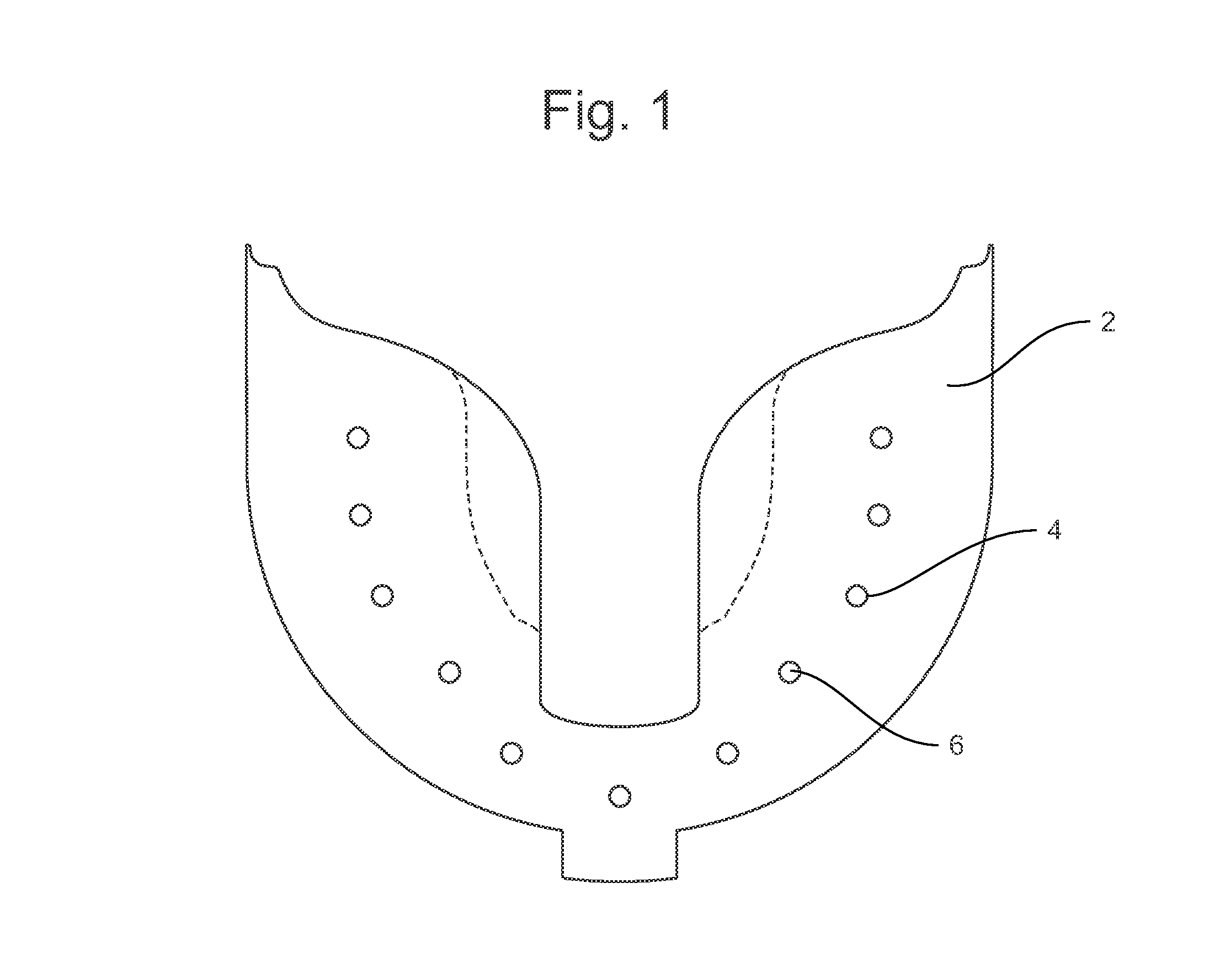 Positioning jig and improved methods to design and manufacture dental implants