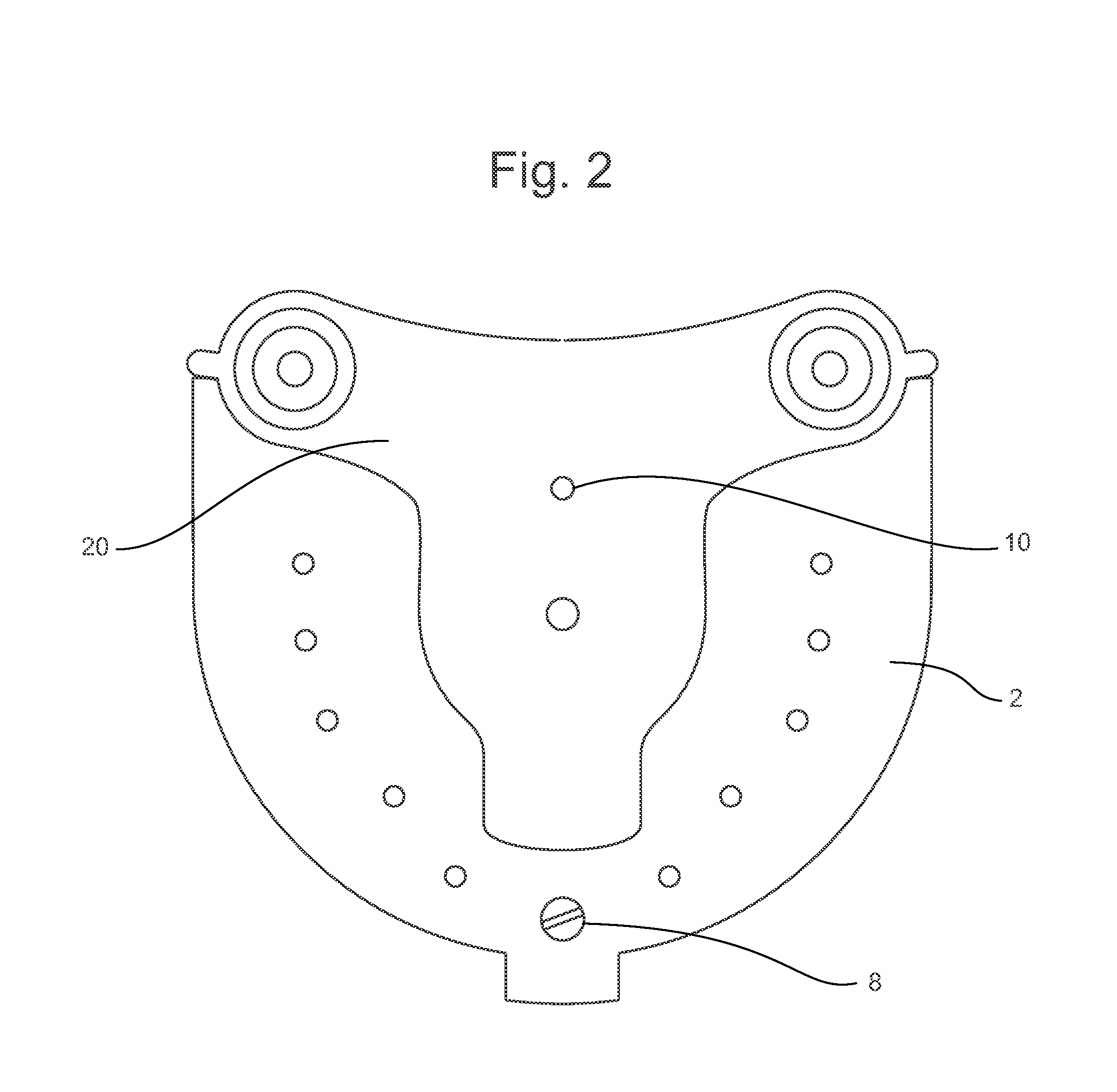 Positioning jig and improved methods to design and manufacture dental implants