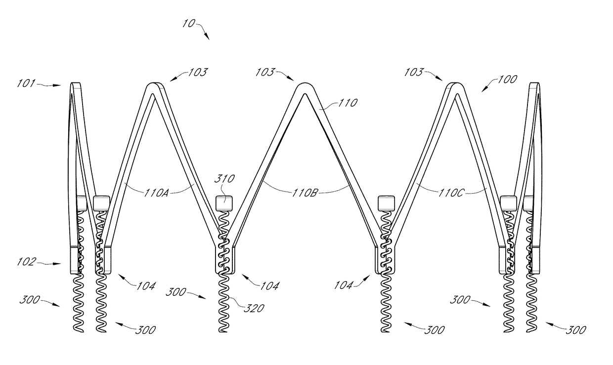 Valve replacement using rotational anchors