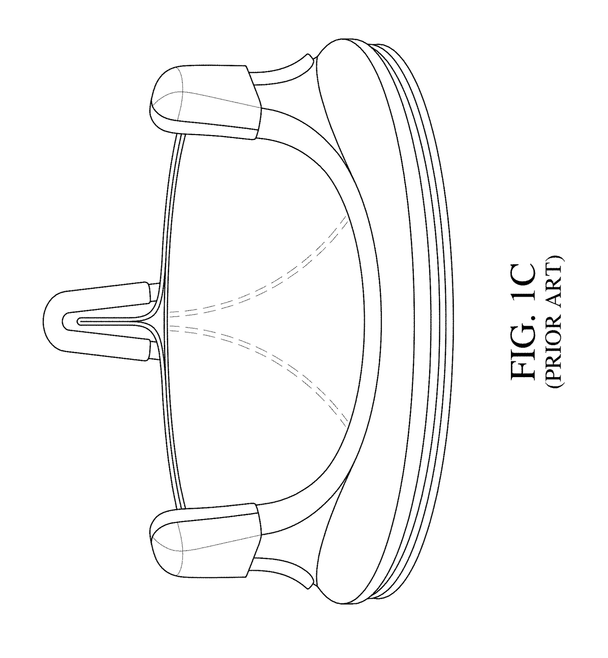 Valve replacement using rotational anchors