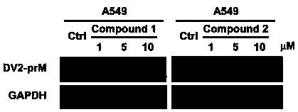 Application of tiacumicin derivative to preparation of medicine for treating related diseases and/or symptoms caused by dengue virus infection