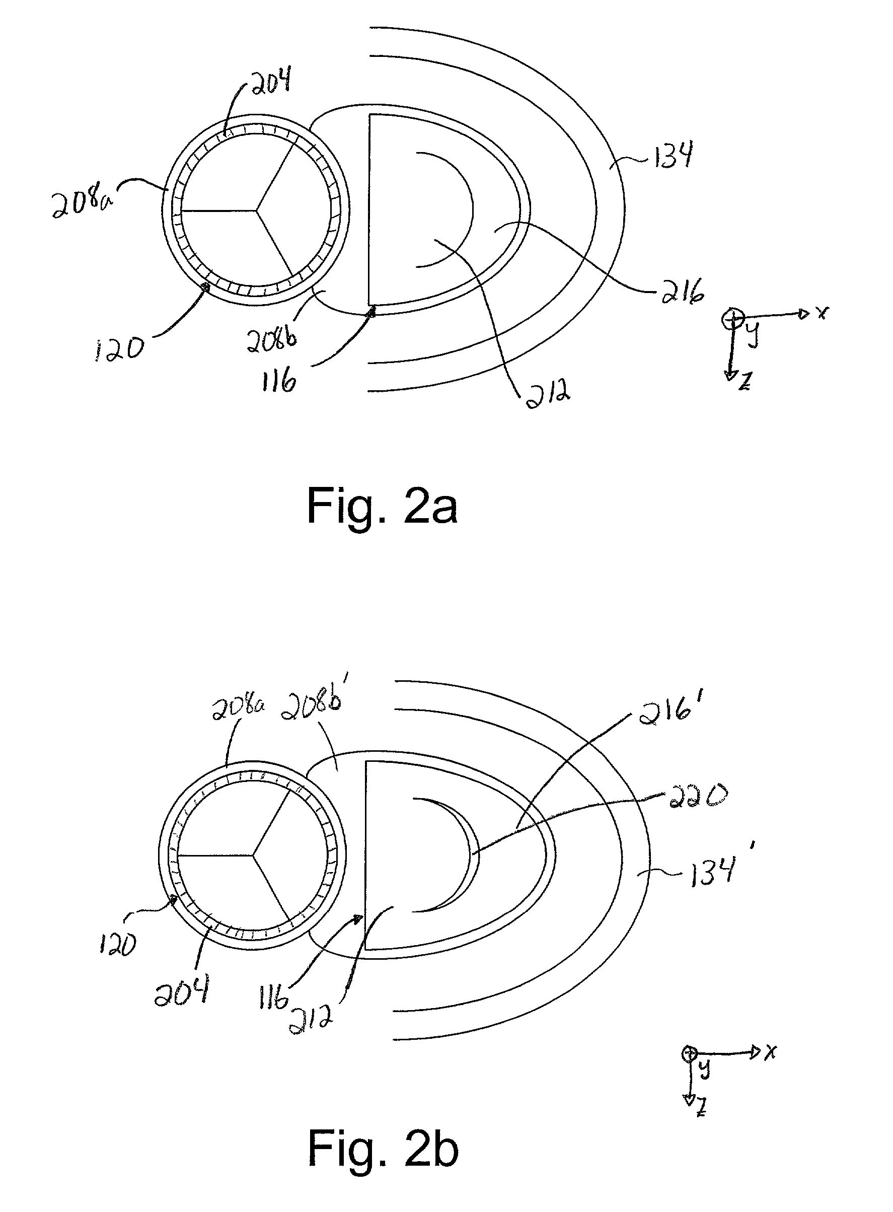 Method and apparatus for catheter-based annuloplasty