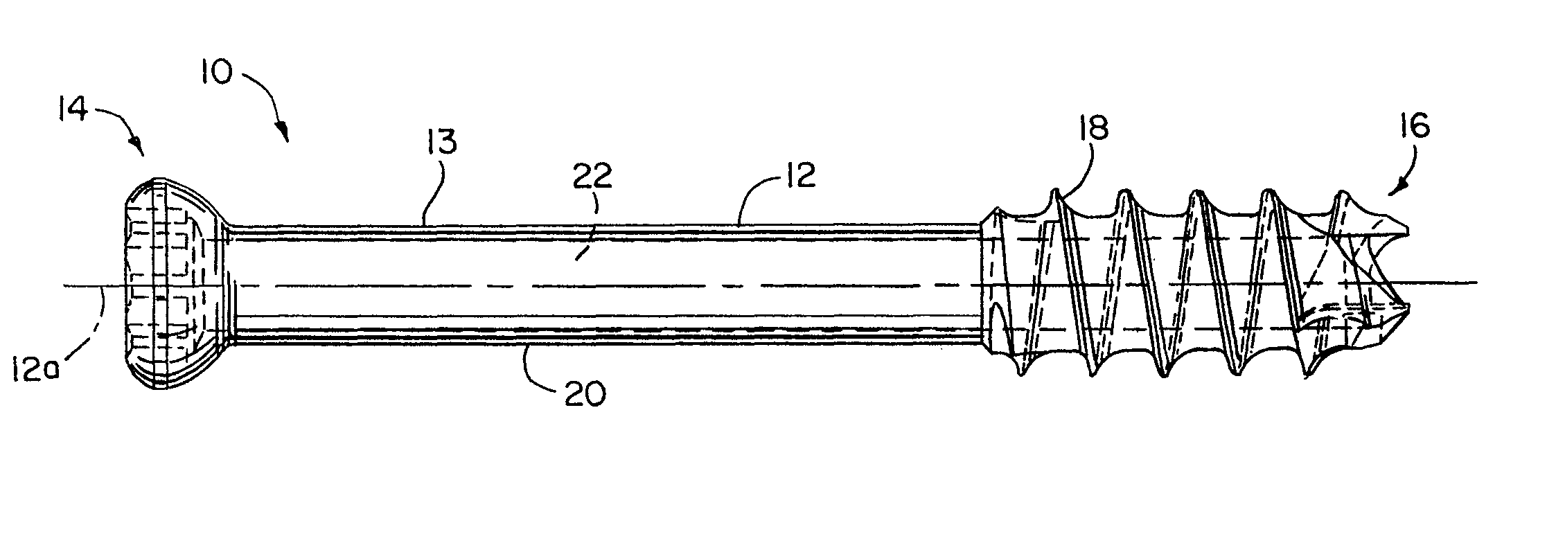 Cannulated bone screw