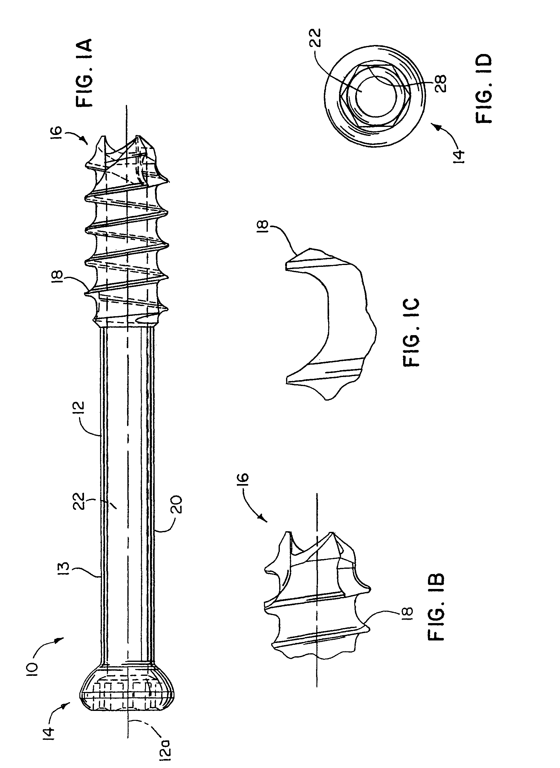 Cannulated bone screw