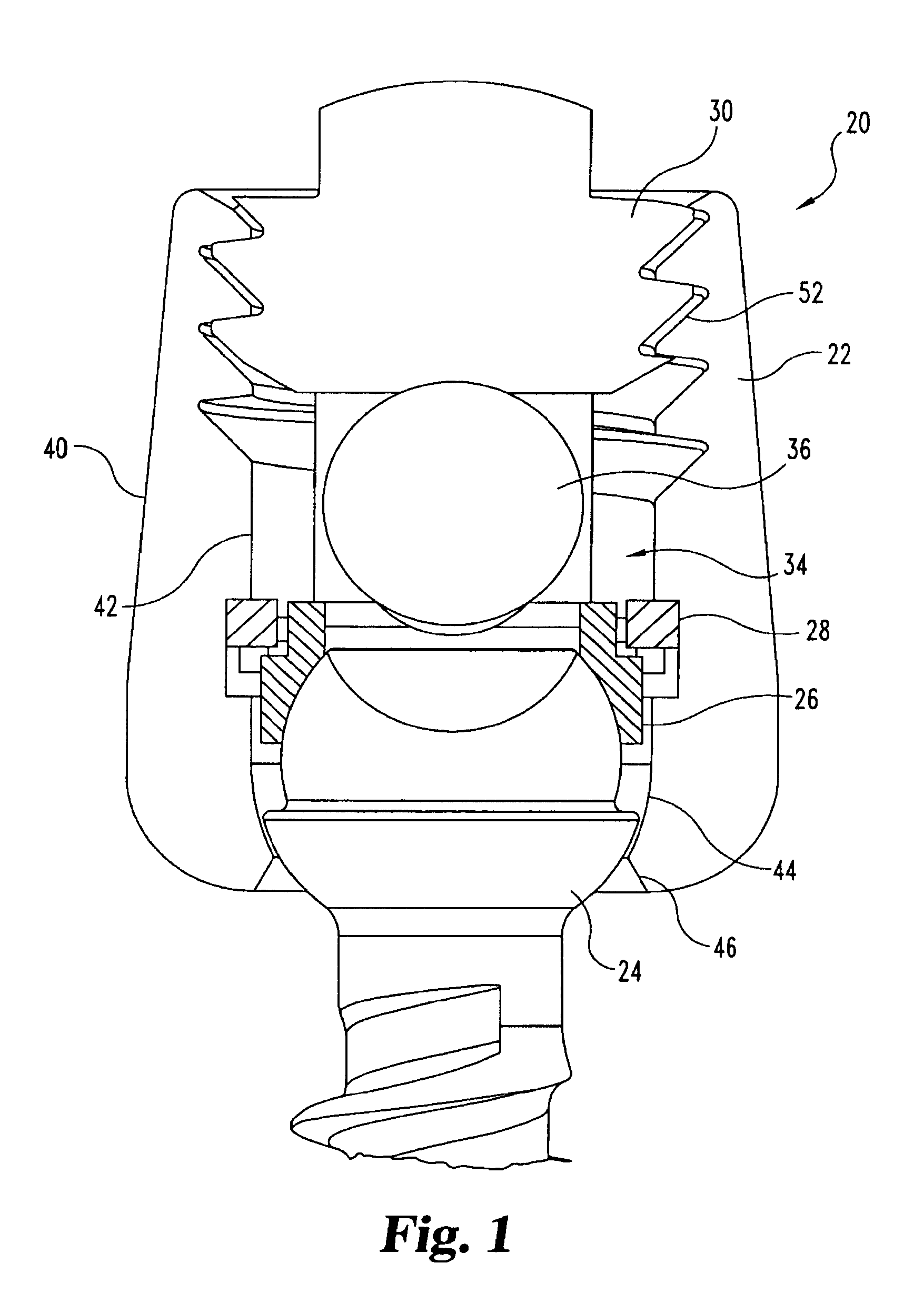 Posterior fixation system