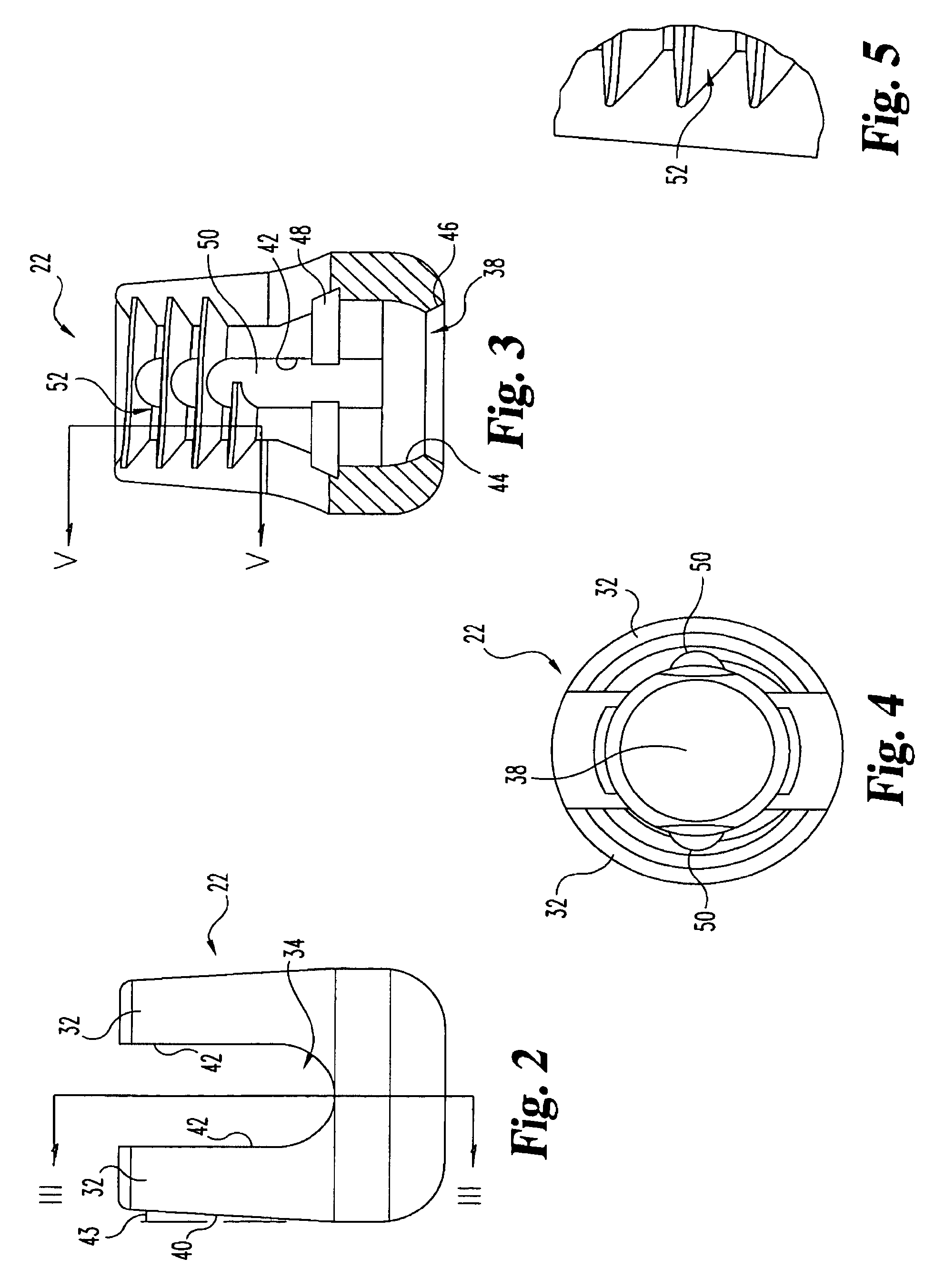 Posterior fixation system