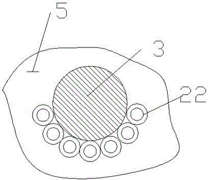 Nut protein extraction device with two-level subsidiary teeth and feeding sensor