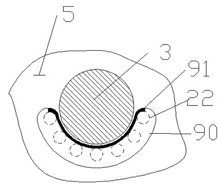 Nut protein extraction device with two-level subsidiary teeth and feeding sensor