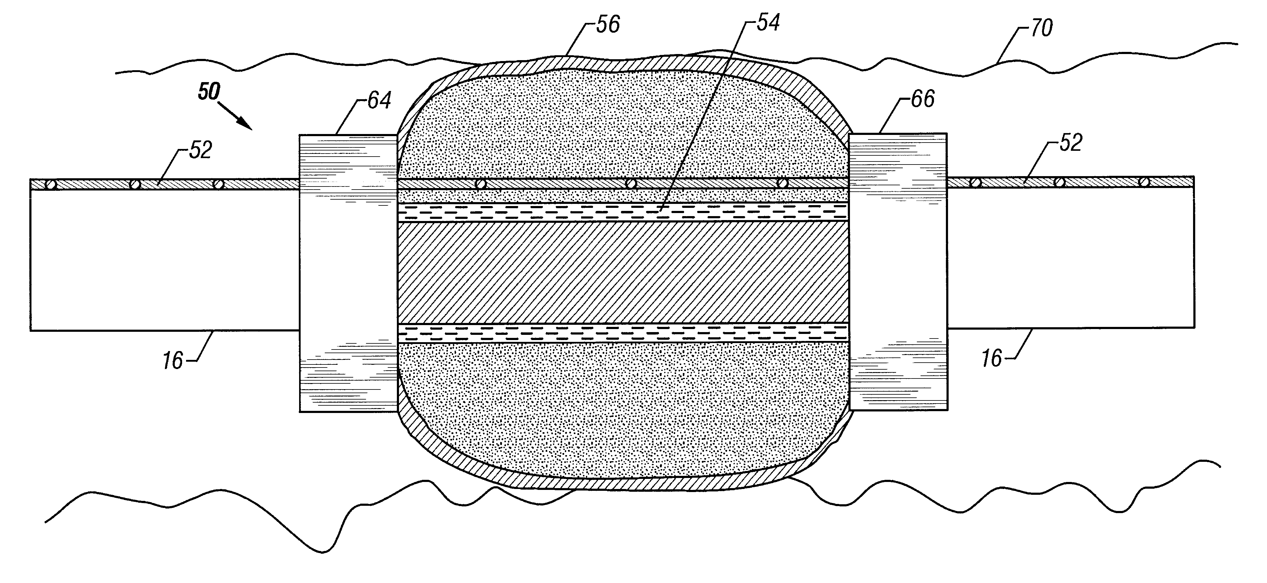 Gravel inflated isolation packer