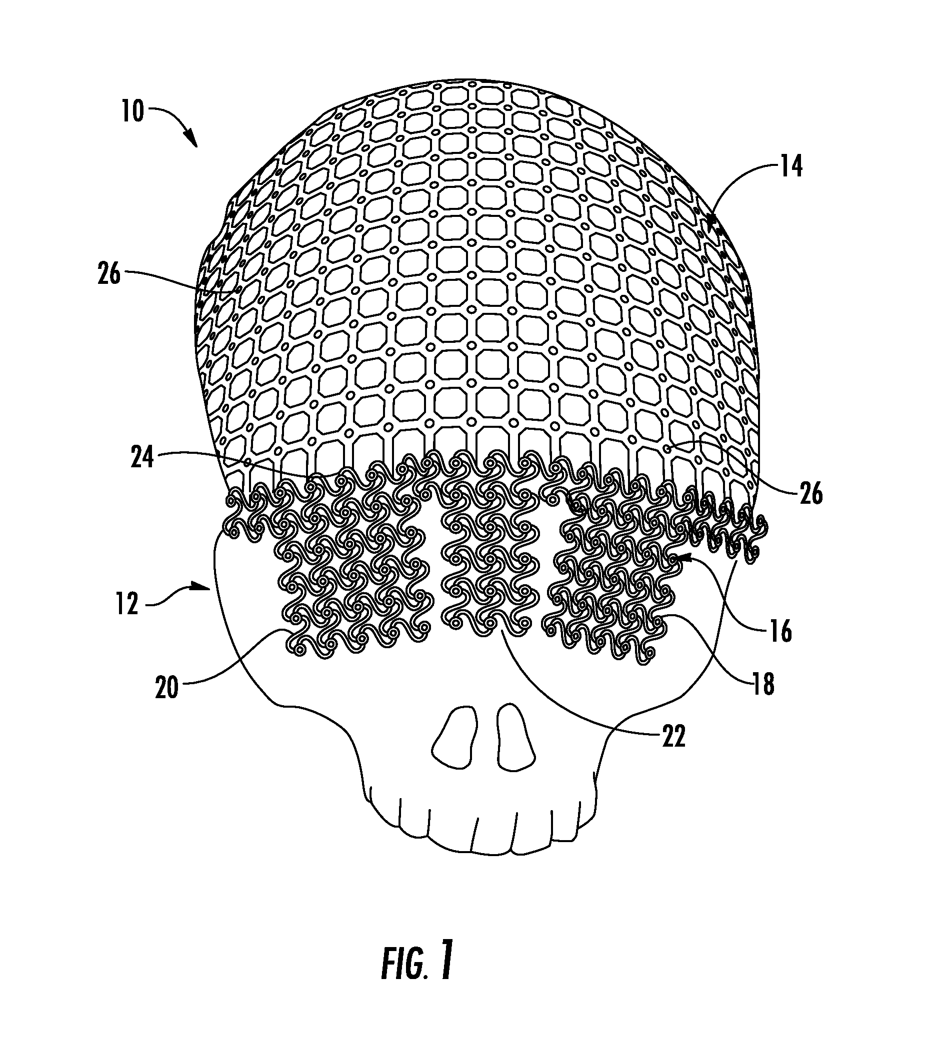 Universal Cranioplasty Mesh