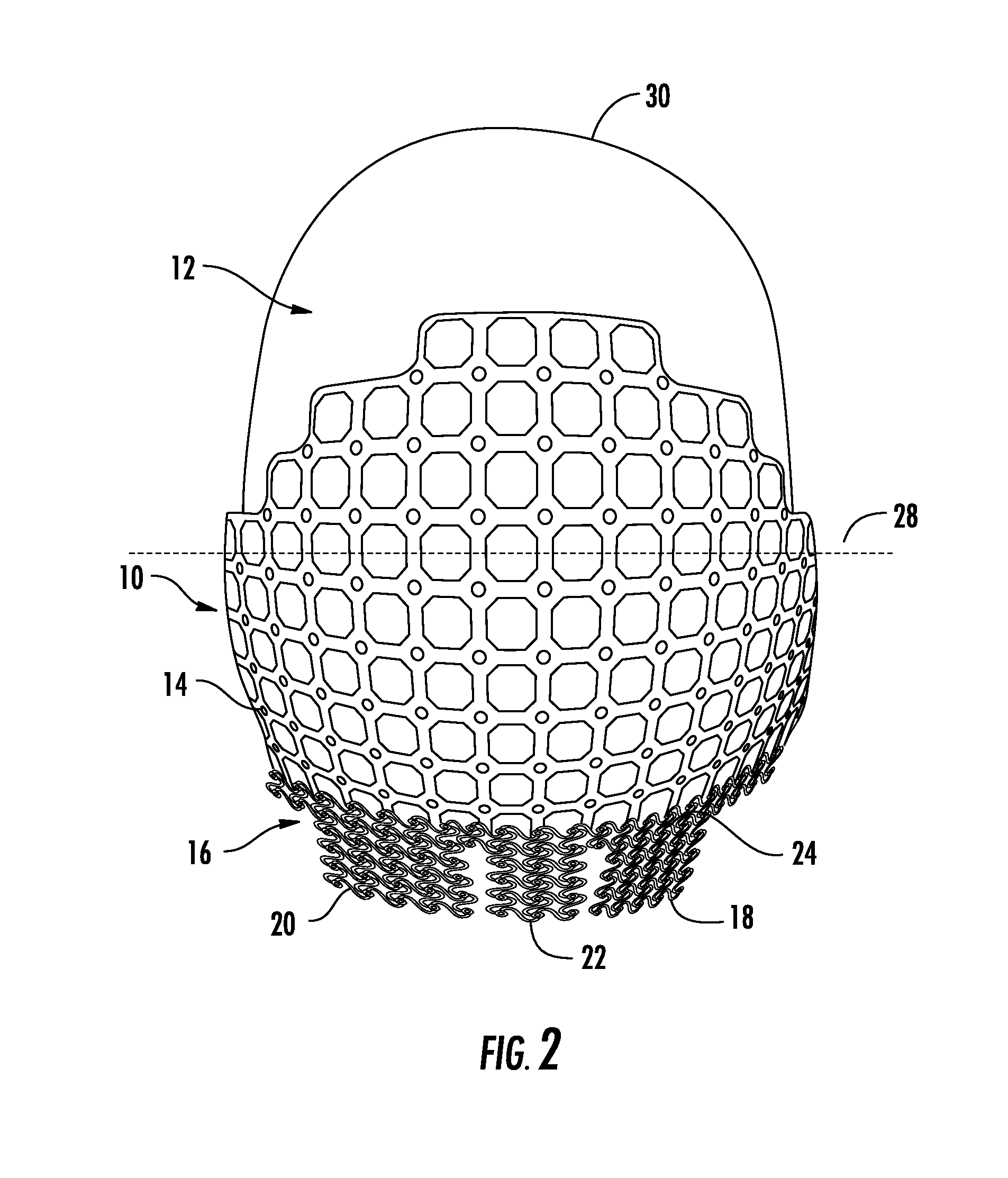 Universal Cranioplasty Mesh