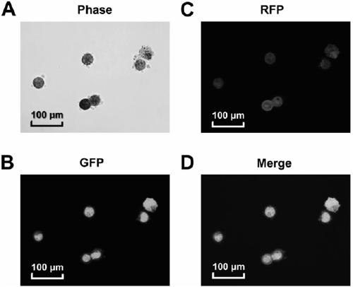 Humanized adipose-derived stem cell exosome and preparation method and application thereof