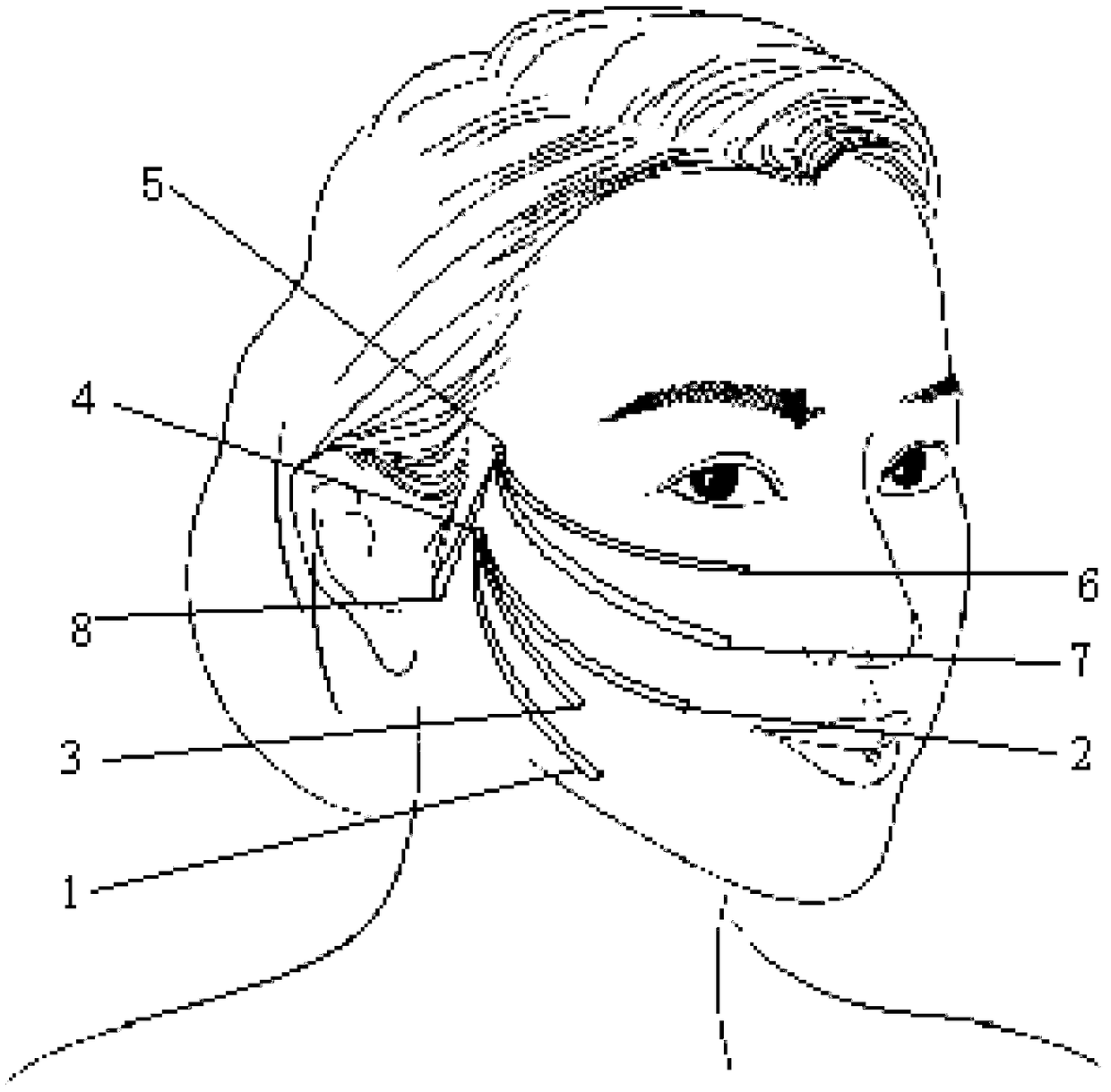 'Double-M and one fixing point' type face thread-burying soft tissue restoration technology