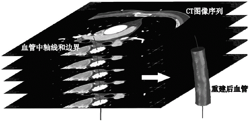 Computational Fluid Dynamics (CFD) based coronary artery blood flow simulating system and method