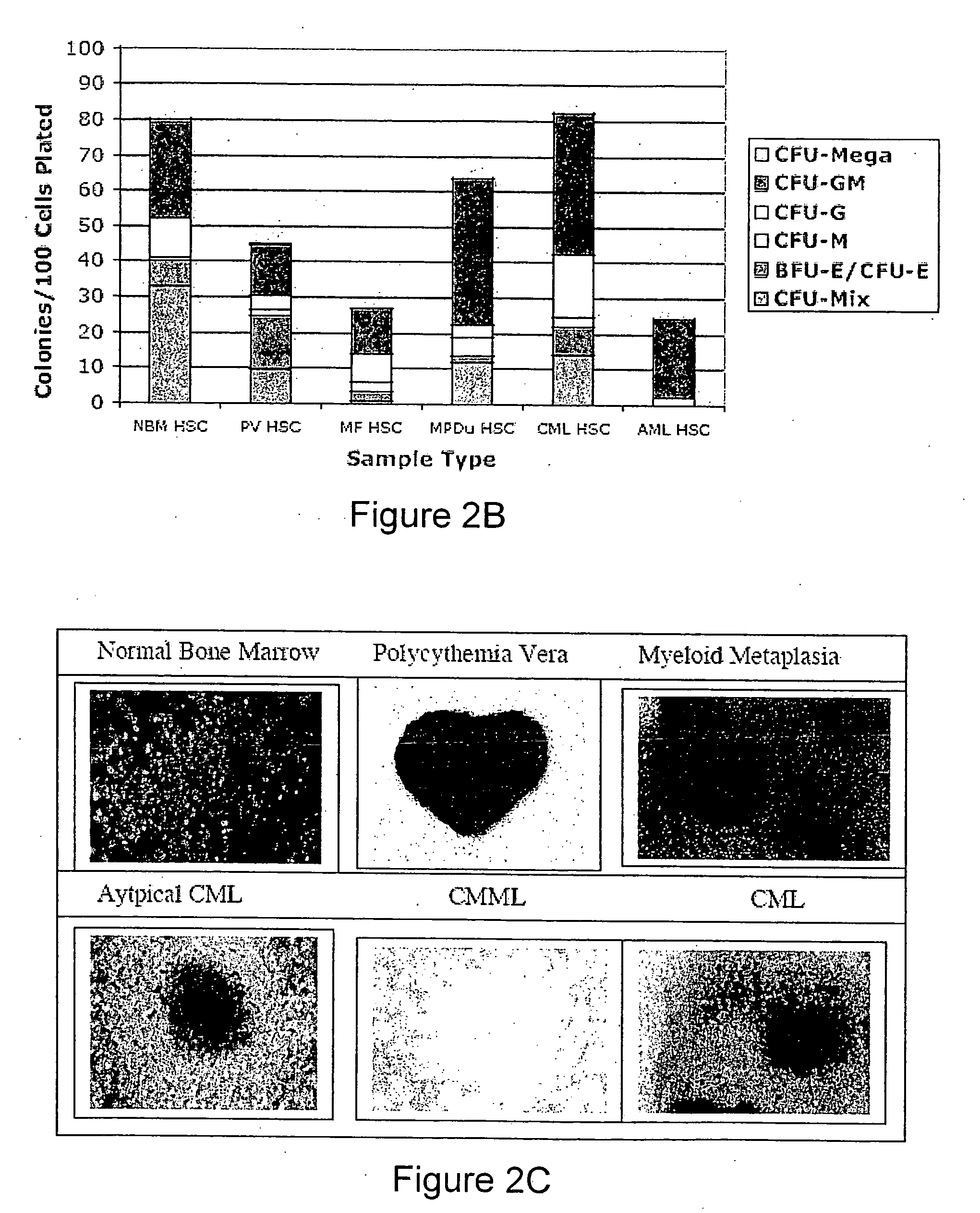 Methods for diagnosing and evaluating treatment of blood disorders