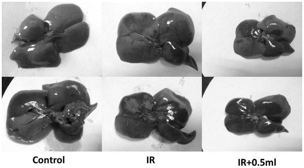 Application of Methane Injection in Preparation of Drugs for Treating Ischemia-Reperfusion Injury