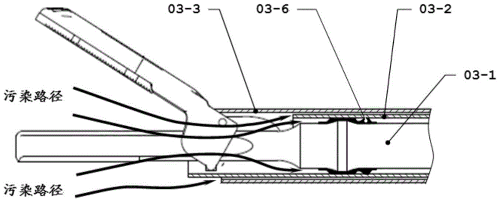 Ultrasonic scalpel bar with replaceable scalpel head