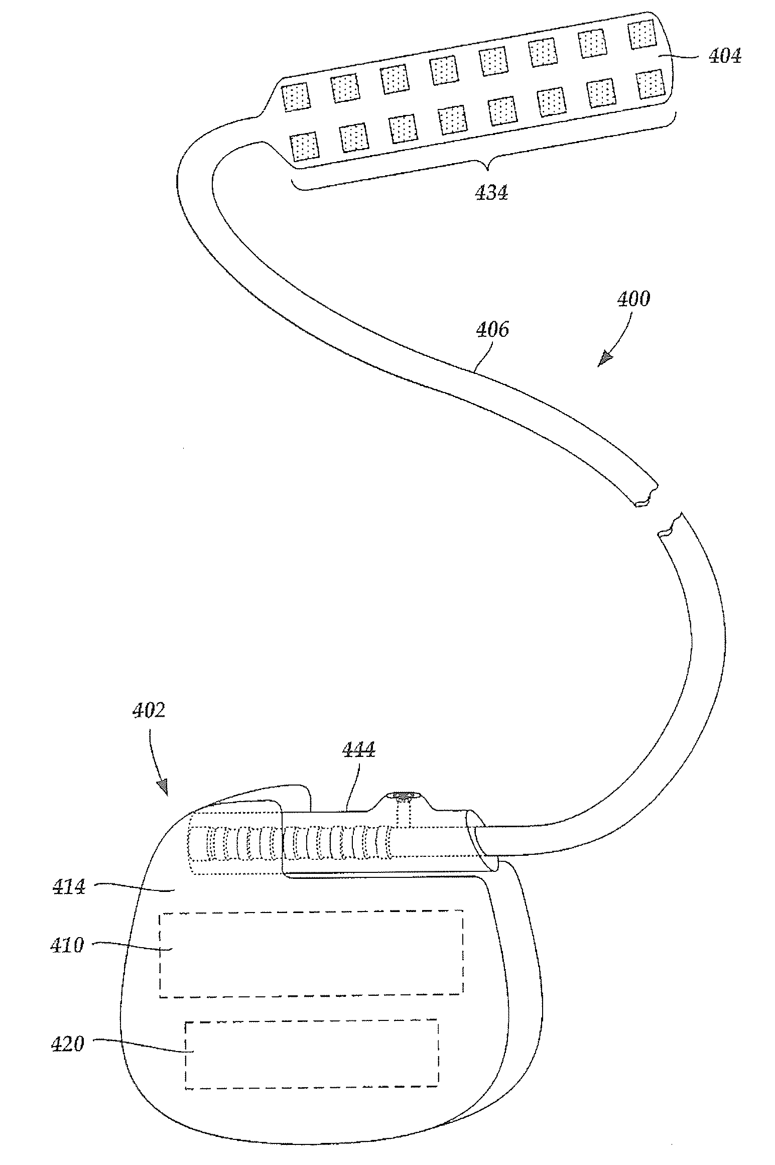 Systems and methods for treating essential tremor or restless leg syndrome using spinal cord stimulation