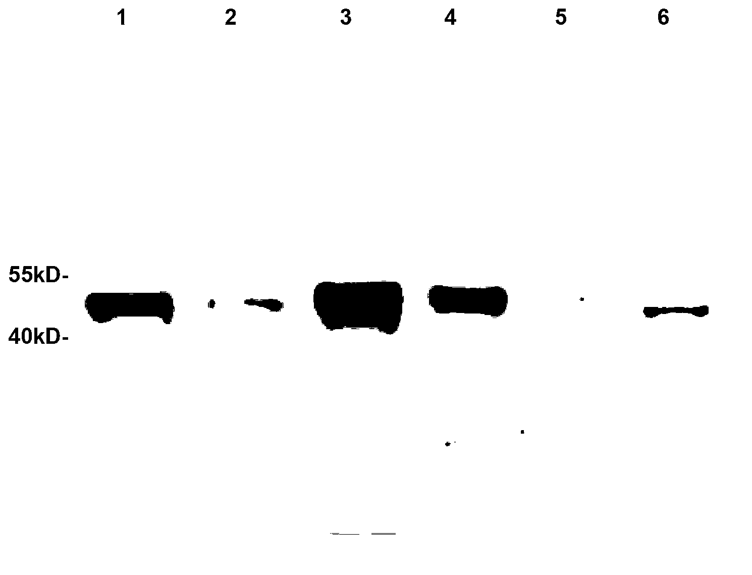 Duck flavivirus subunit vaccine, as well as a preparation method and application thereof