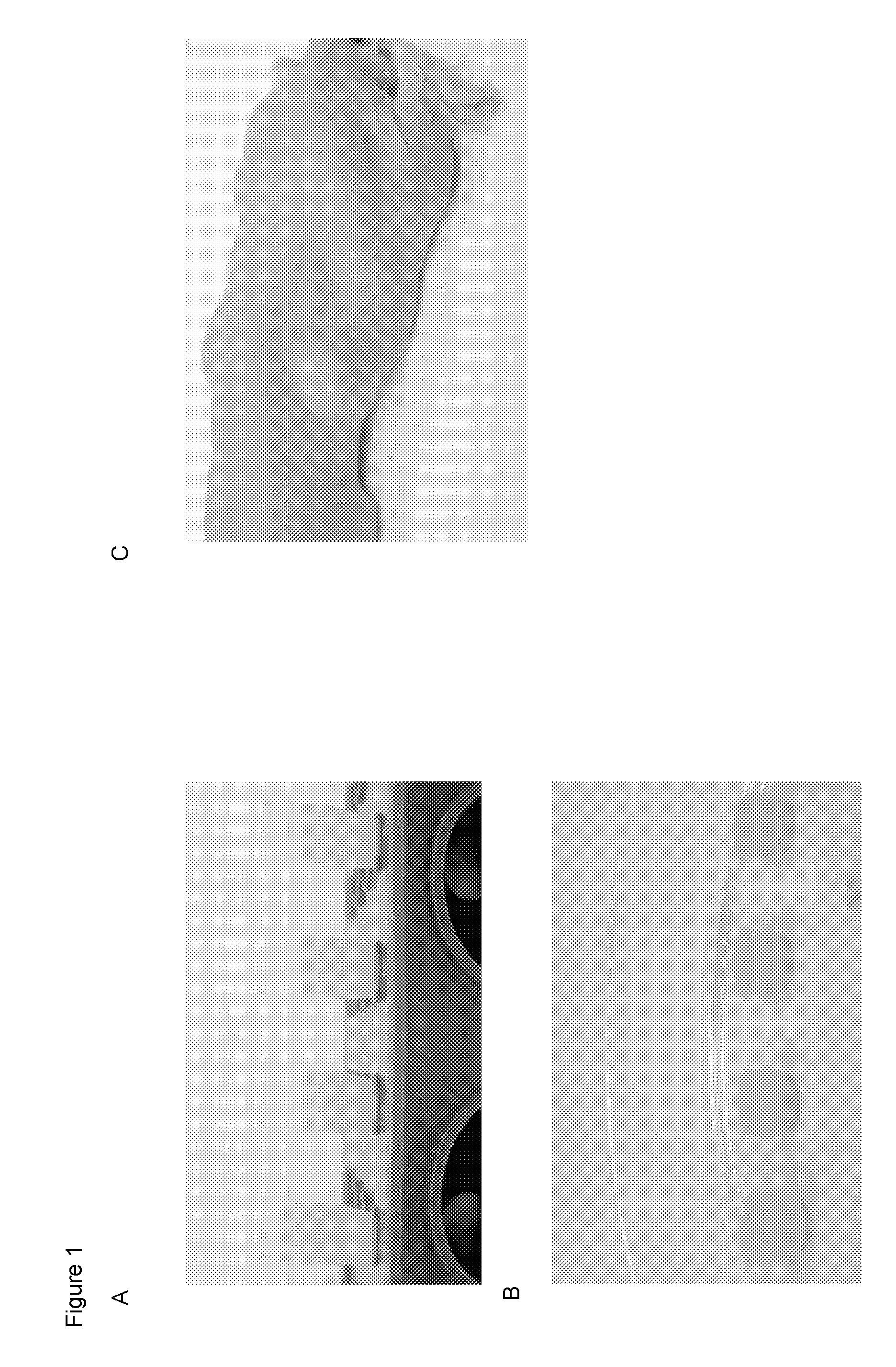 Compositions and Methods for Implantation of Processed Adipose Tissue and Processed Adipose Tissue Products