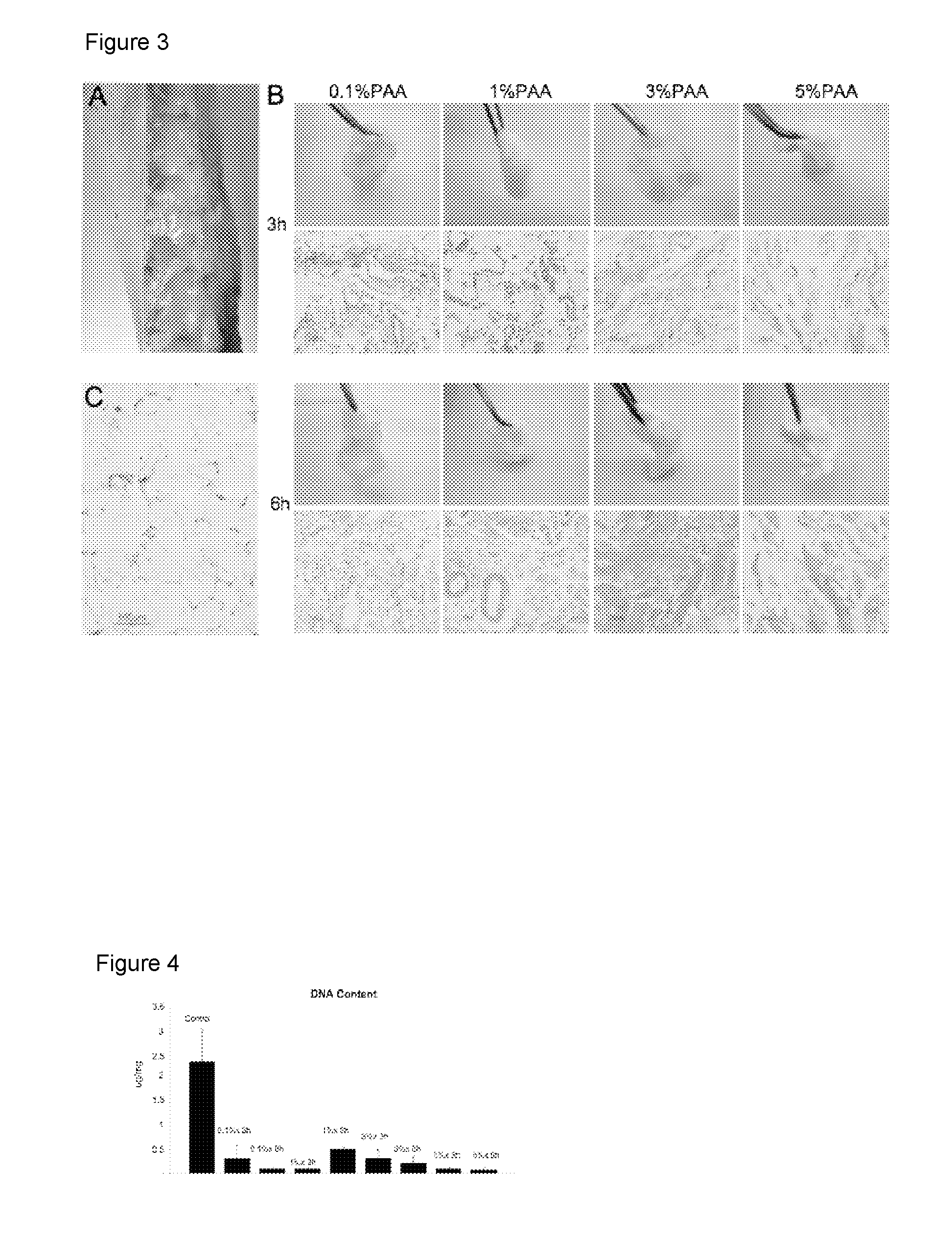 Compositions and Methods for Implantation of Processed Adipose Tissue and Processed Adipose Tissue Products