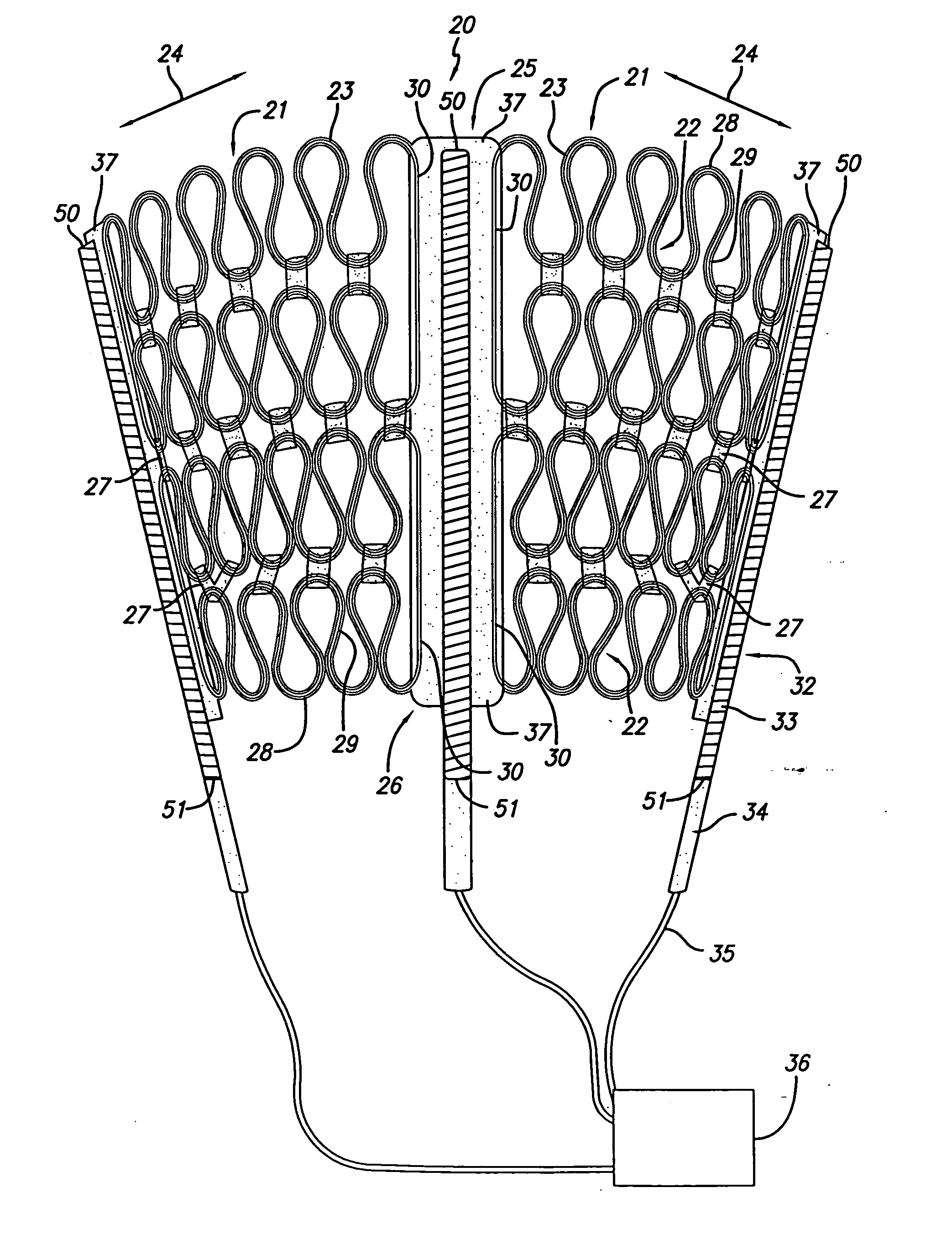 Cardiac harness for treating congestive heart failure and for defibrillating and/or pacing/sensing