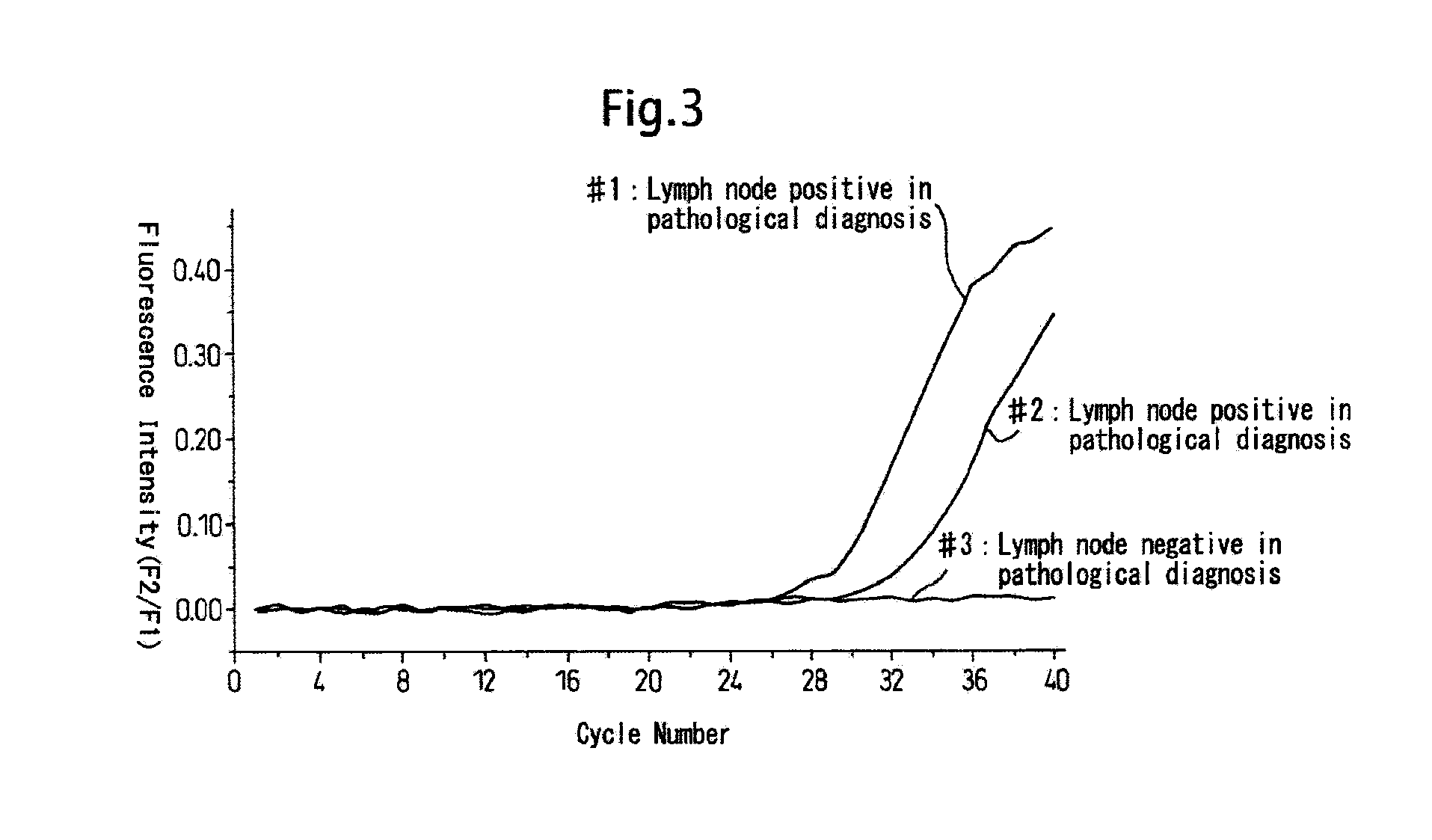 Method for quick determination of cytokeratin 19 (CK19) and primers and probes therefore