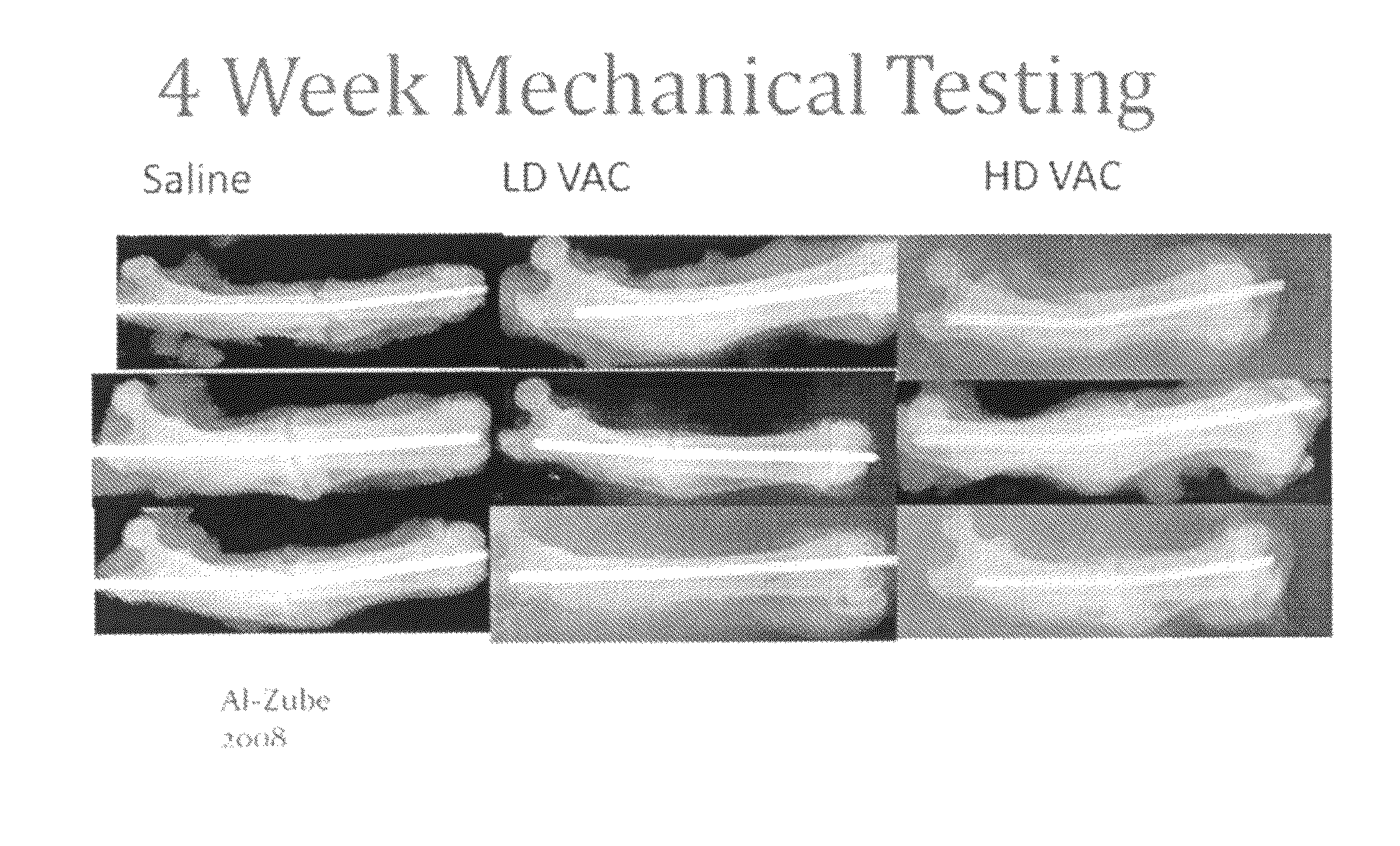 Use of vanadium compounds to accelerate bone healing