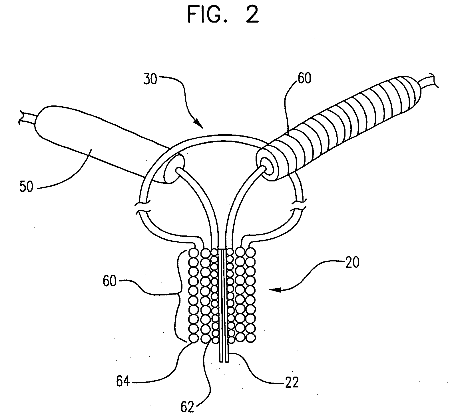 Expansible neck bridge