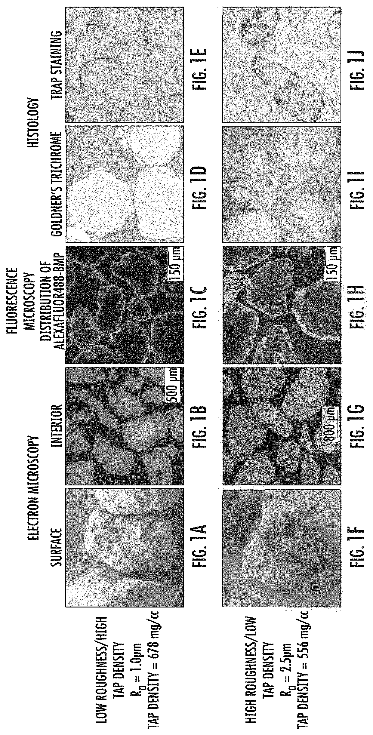 Porous carrier matrix