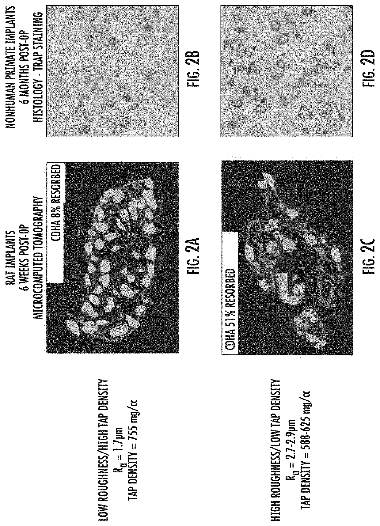 Porous carrier matrix