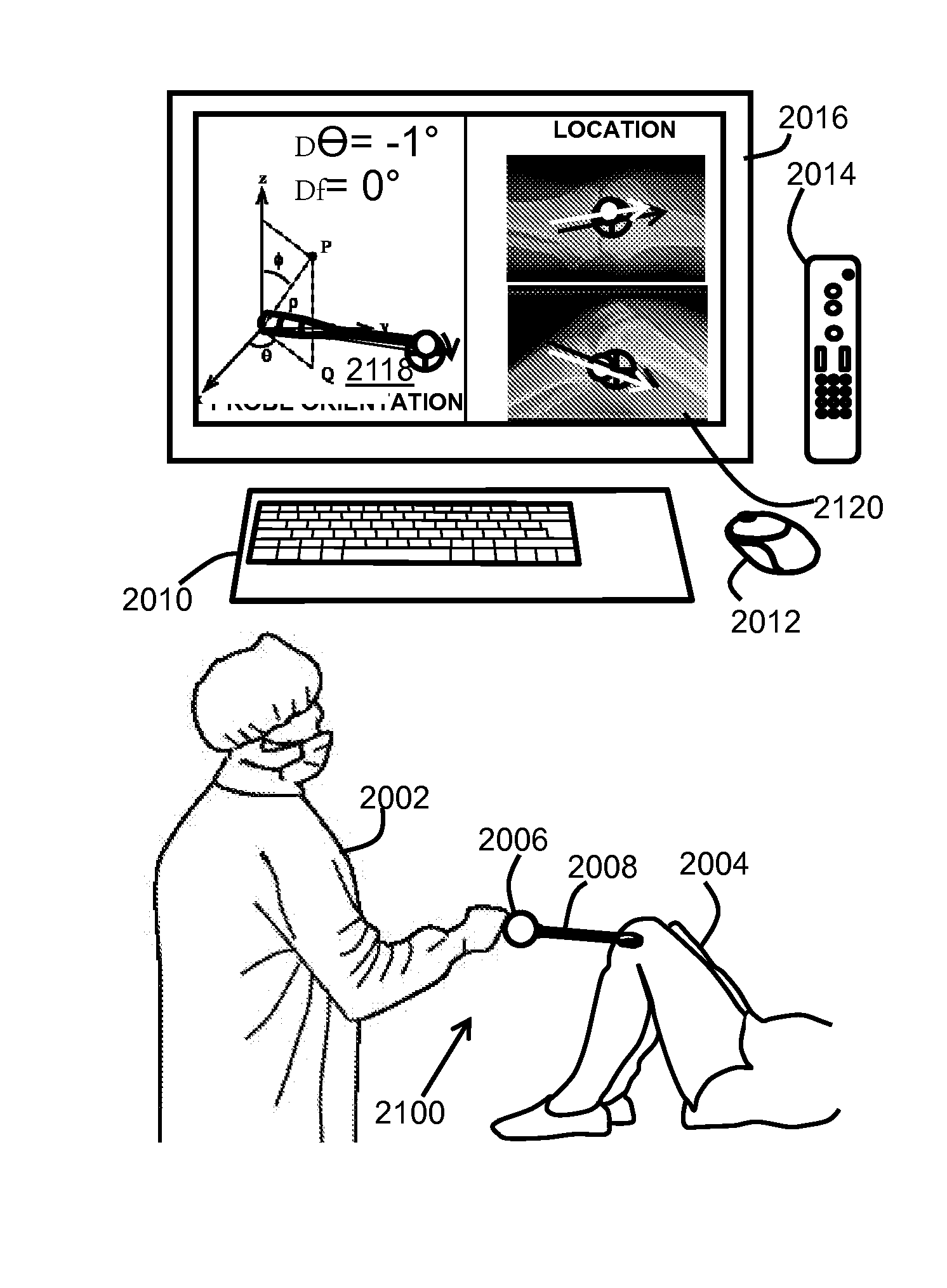 Motion and orientation sensing module or device for positioning of implants