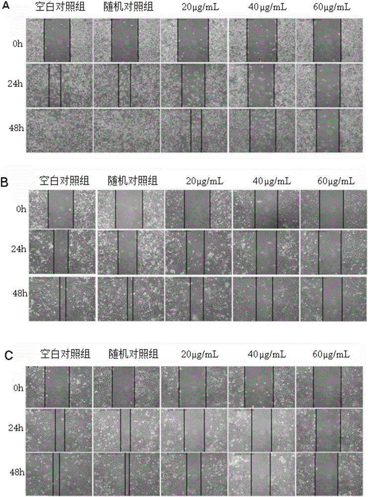 Anti-tumor polypeptide and preparation method and application of anti-tumor polypeptide