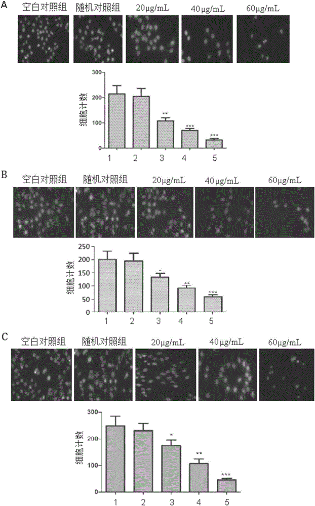 Anti-tumor polypeptide and preparation method and application of anti-tumor polypeptide