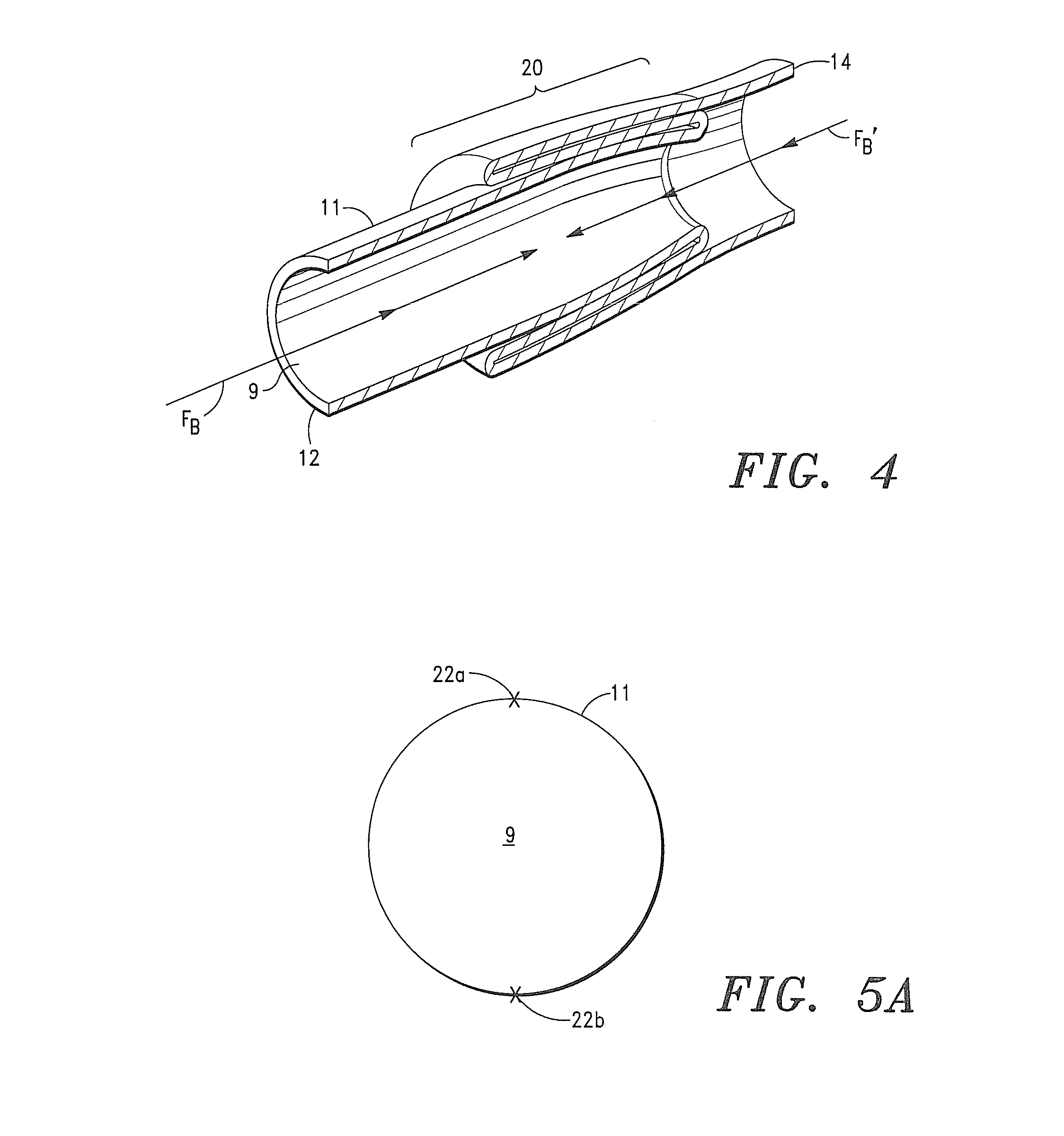 Seamless Tubular Extracellular Matrix Prosthetic Valve and Method for Forming Same