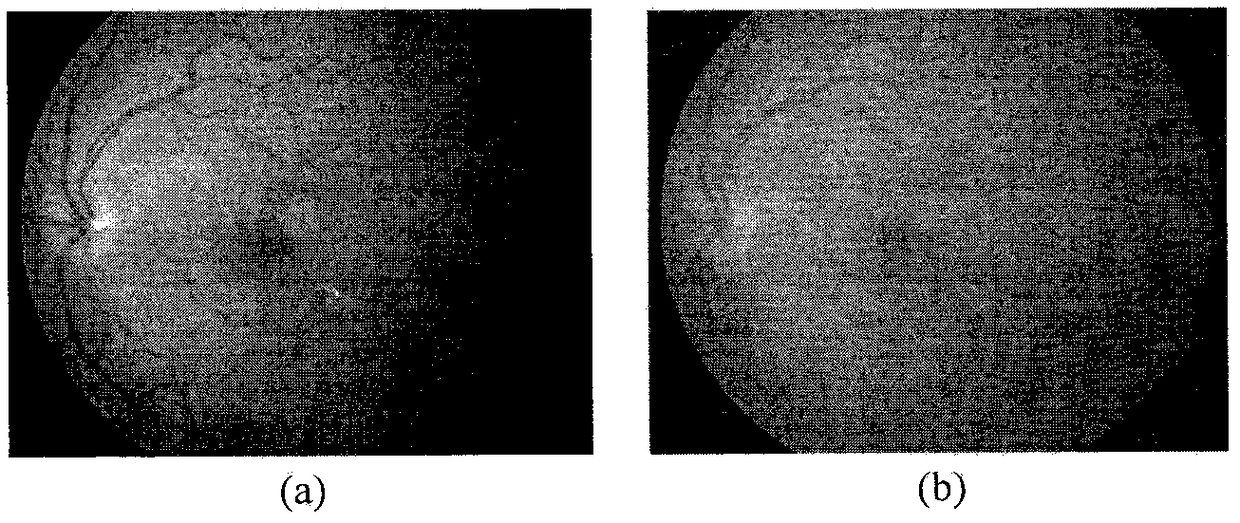 A method for detecting the rigid exudate lesion in a fundus image based on a convolution neural network